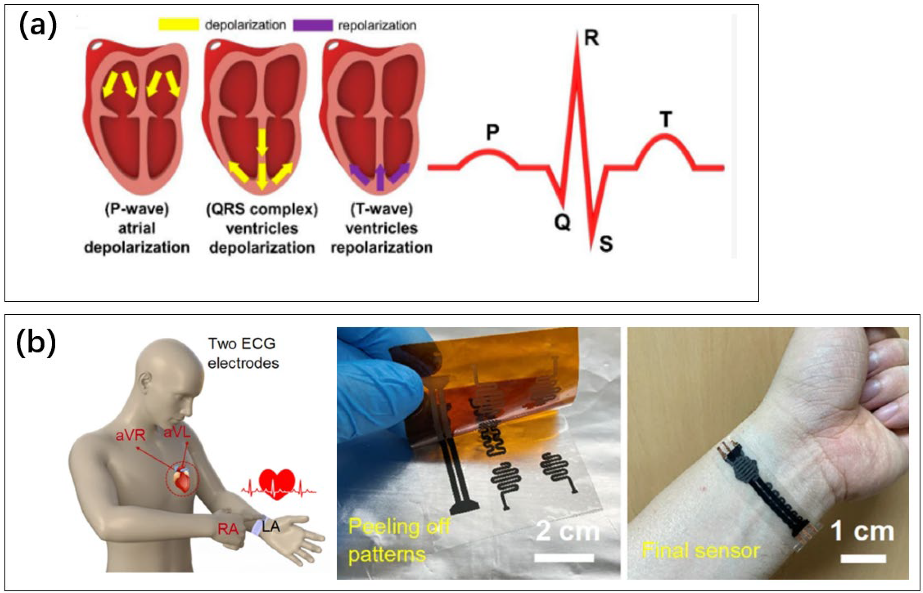 Biosensors 13 00395 g007 Biosensors 13 00395 g007