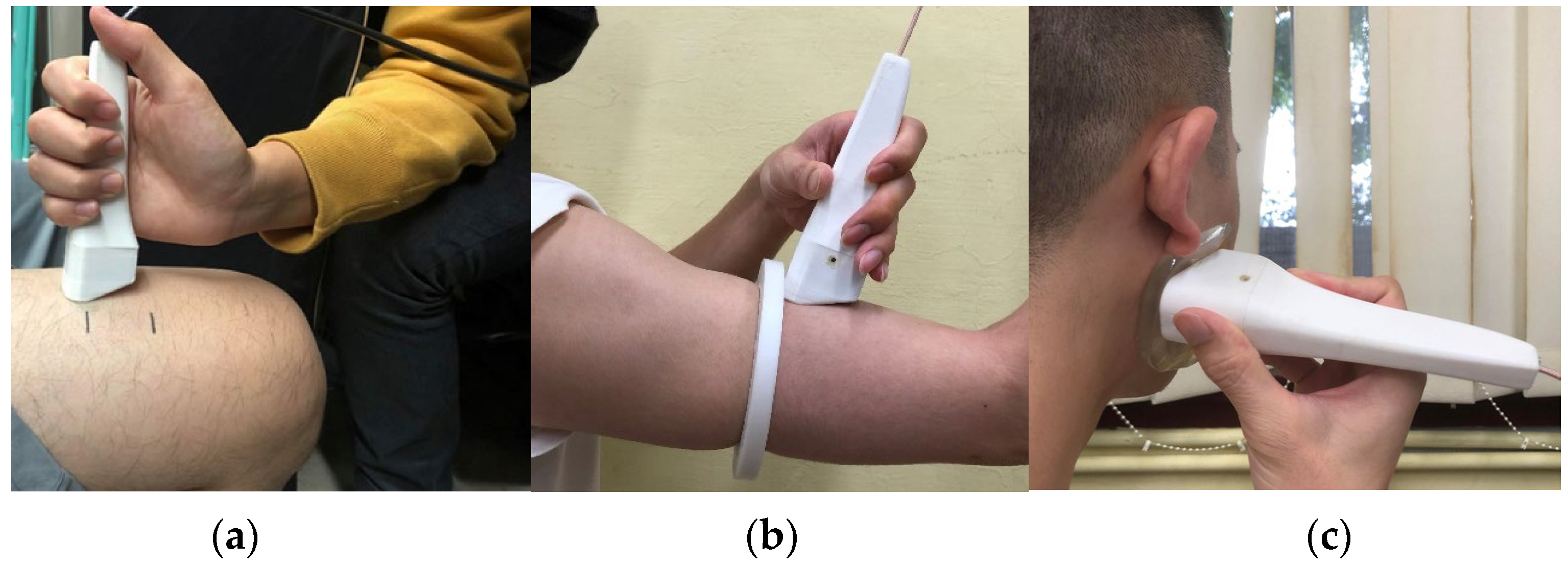 Biosensors 13 00431 g004 Biosensors 13 00431 g004