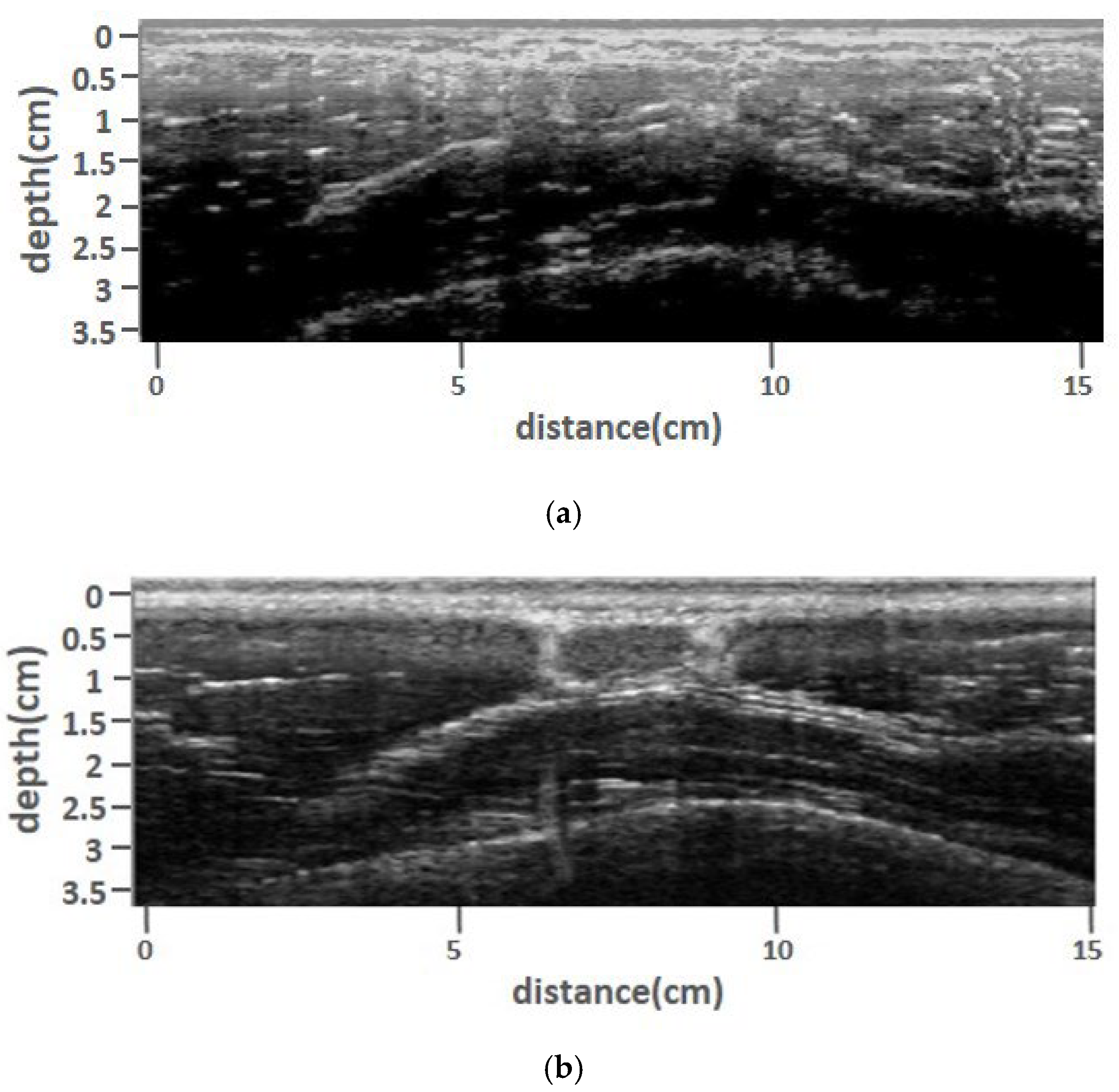 Biosensors 13 00431 g006a Biosensors 13 00431 g006a