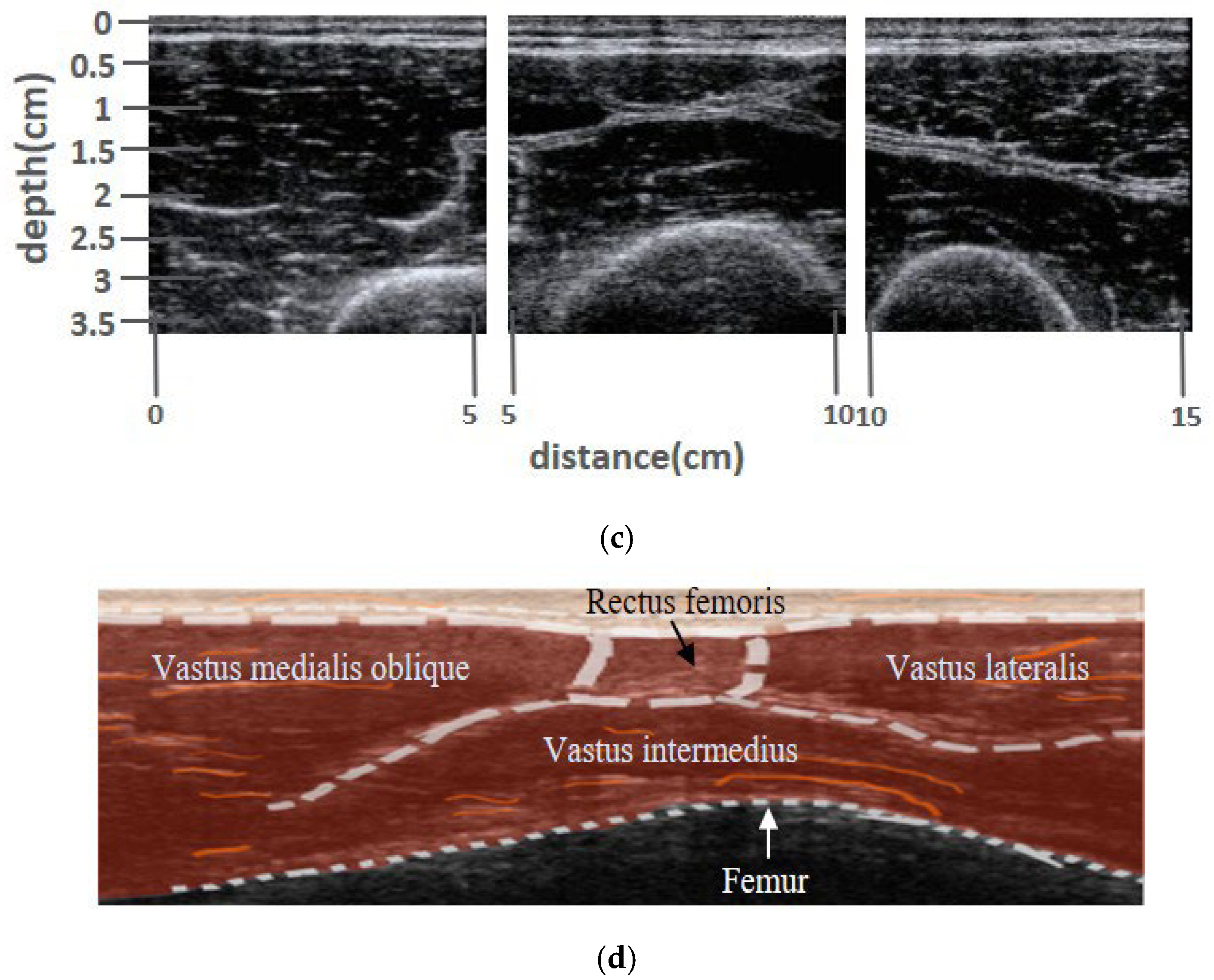 Biosensors 13 00431 g006b Biosensors 13 00431 g006b