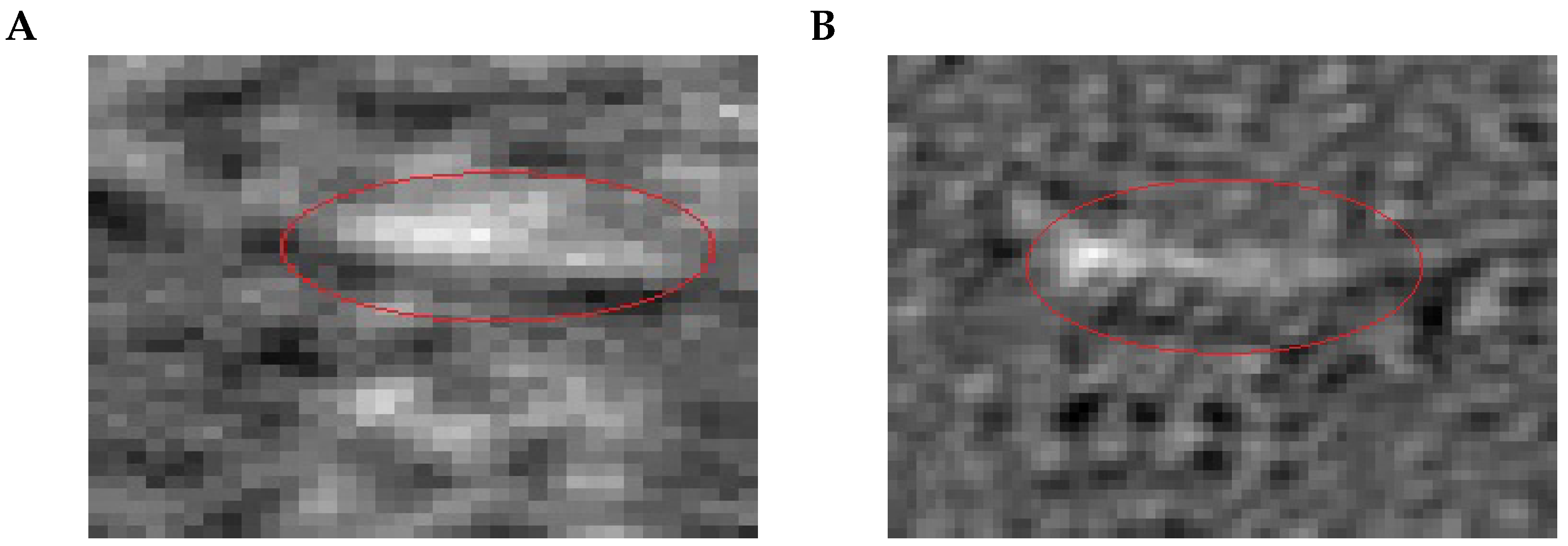 Biosensors 13 00472 g012