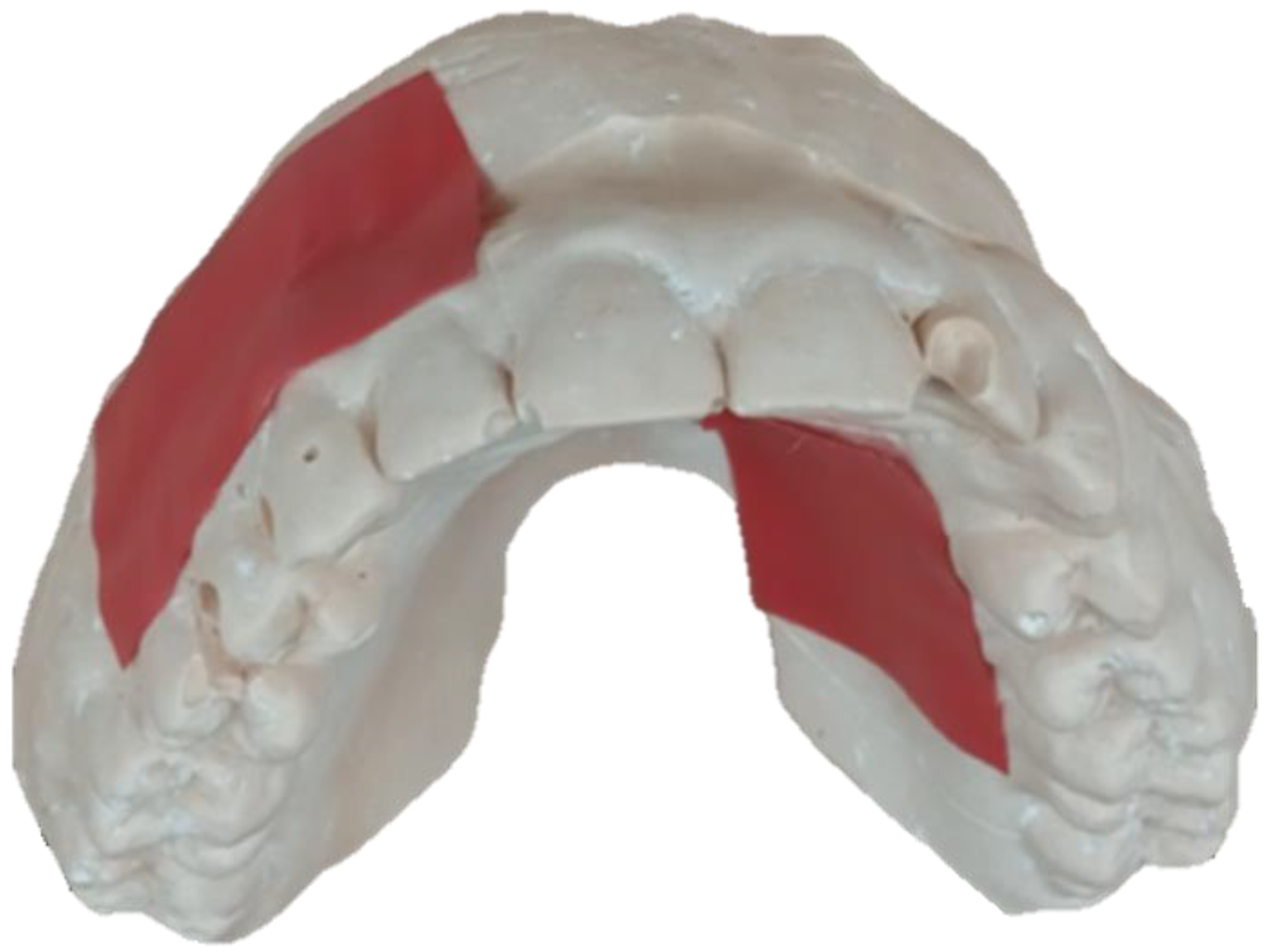 Biosensors 13 00533 g003 Biosensors 13 00533 g003