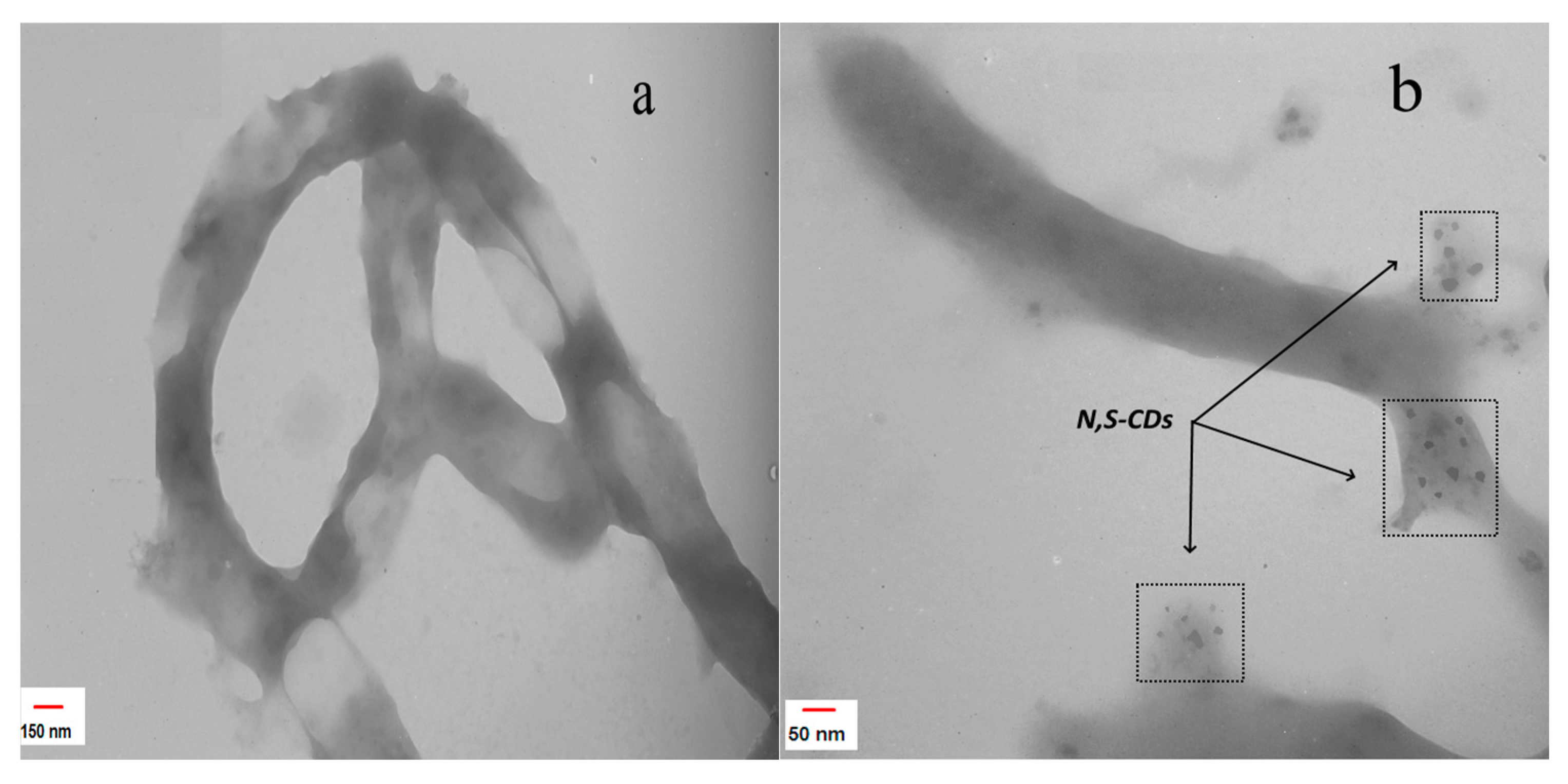 Biosensors 13 00547 g005 Biosensors 13 00547 g005