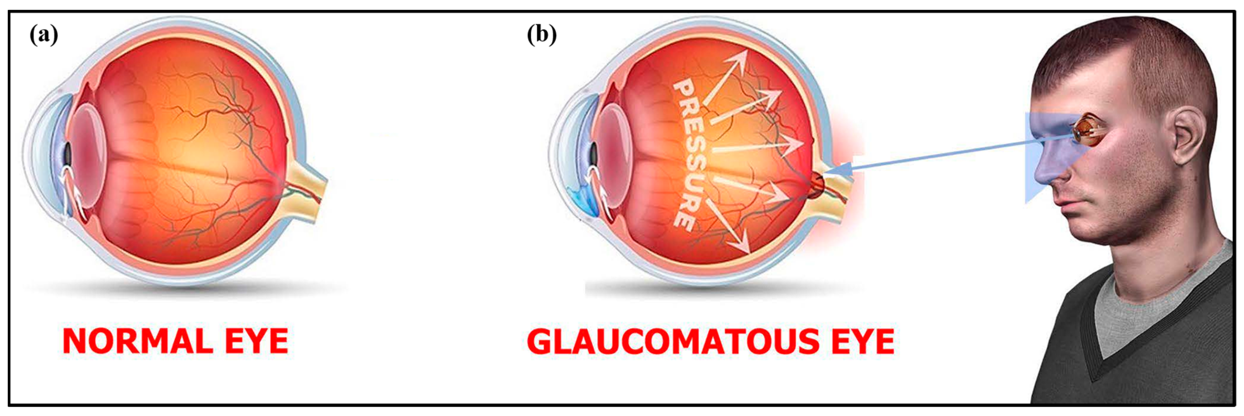Biosensors 13 00663 g004 Biosensors 13 00663 g004