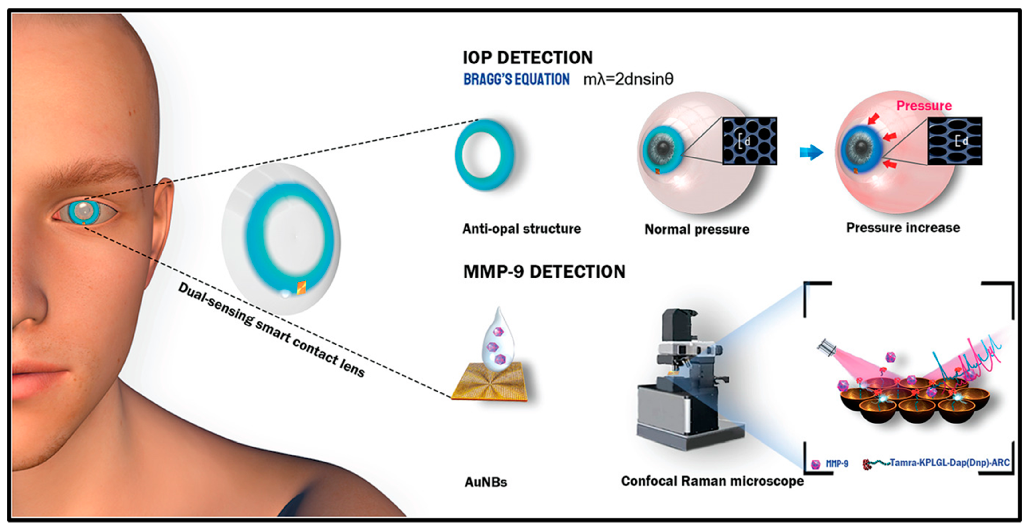 Biosensors 13 00663 g013 Biosensors 13 00663 g013