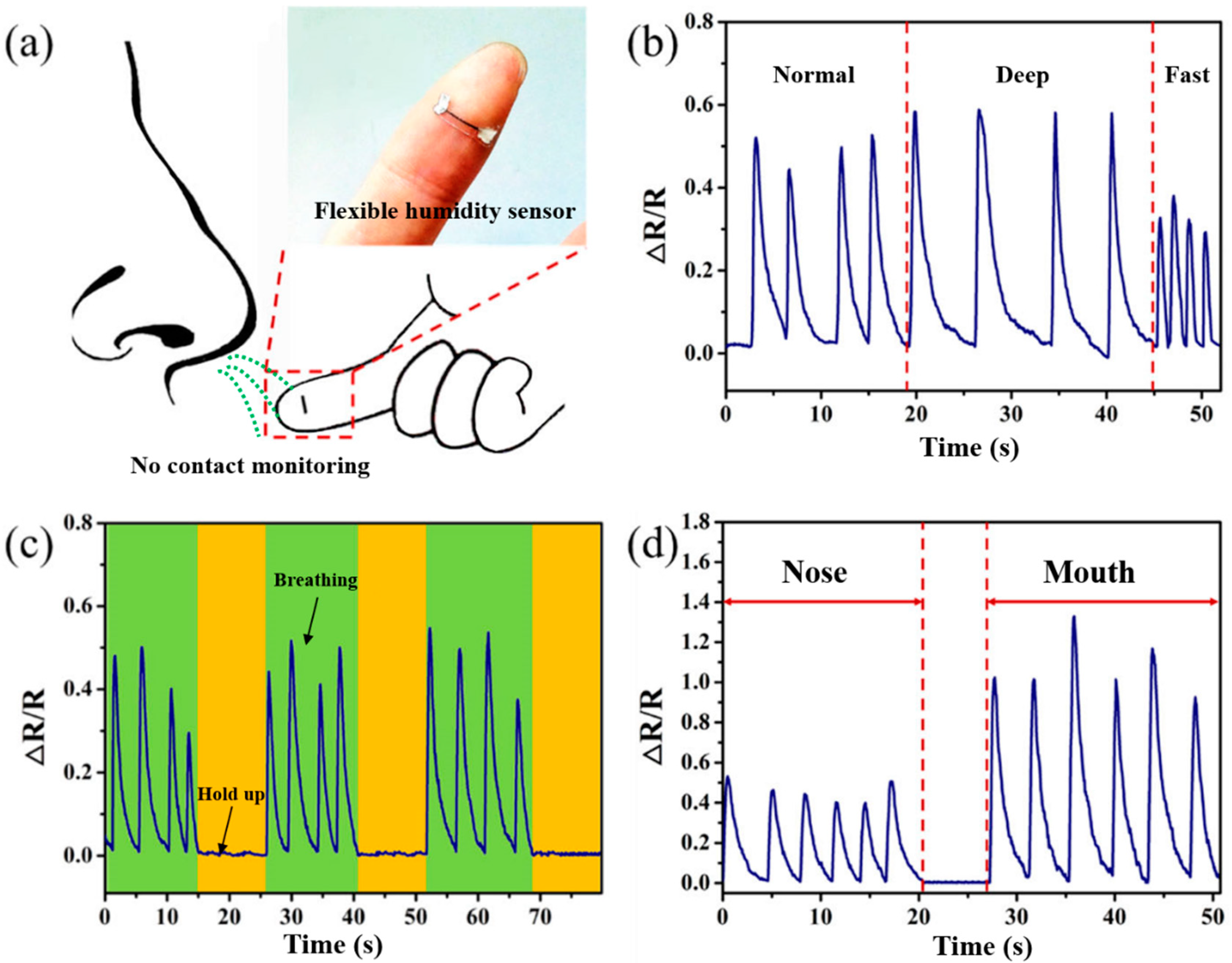 Biosensors 13 00792 g007 Biosensors 13 00792 g007