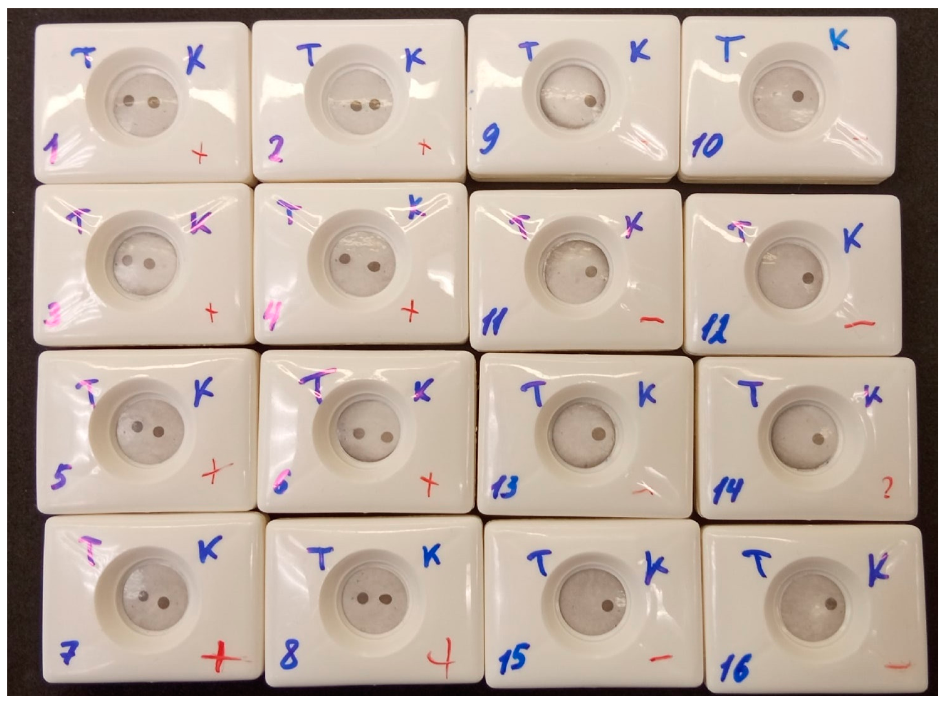 Biosensors 13 00857 g011