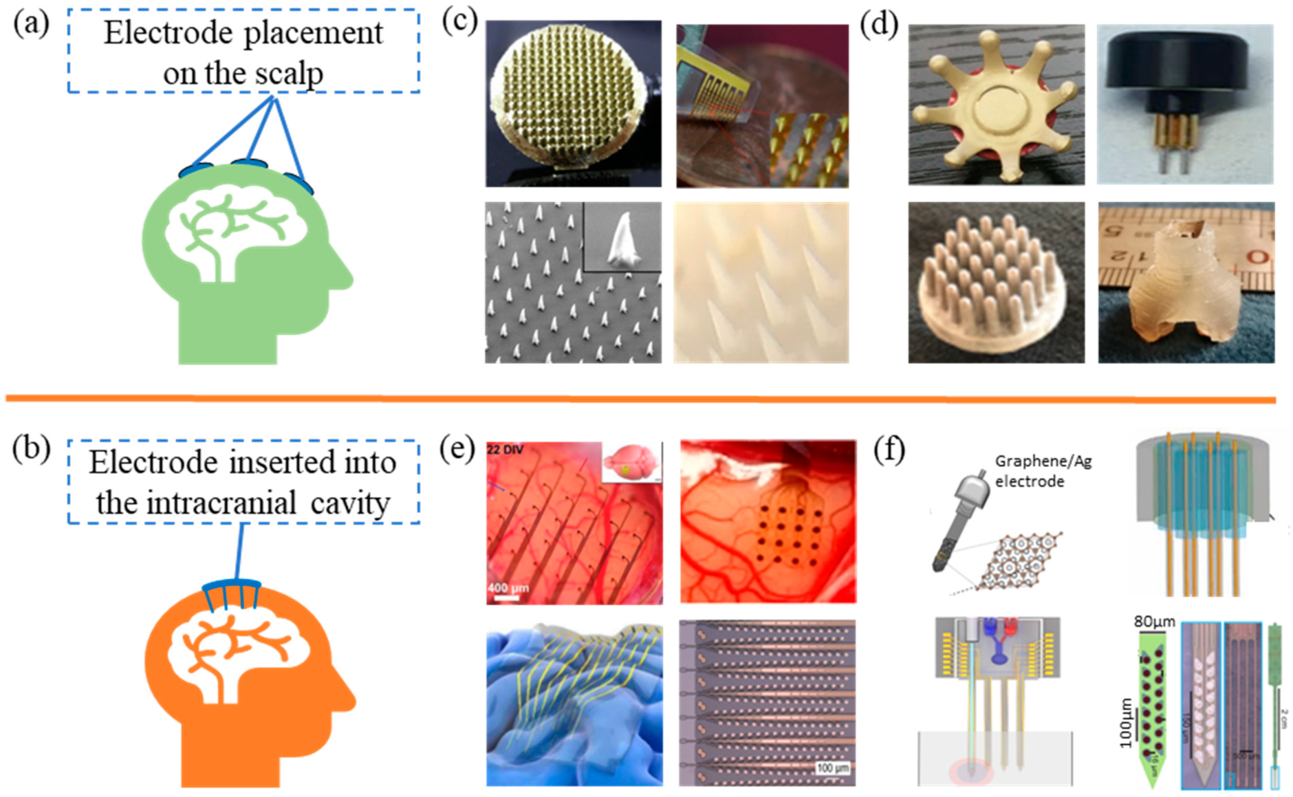 Biosensors 13 00930 g003