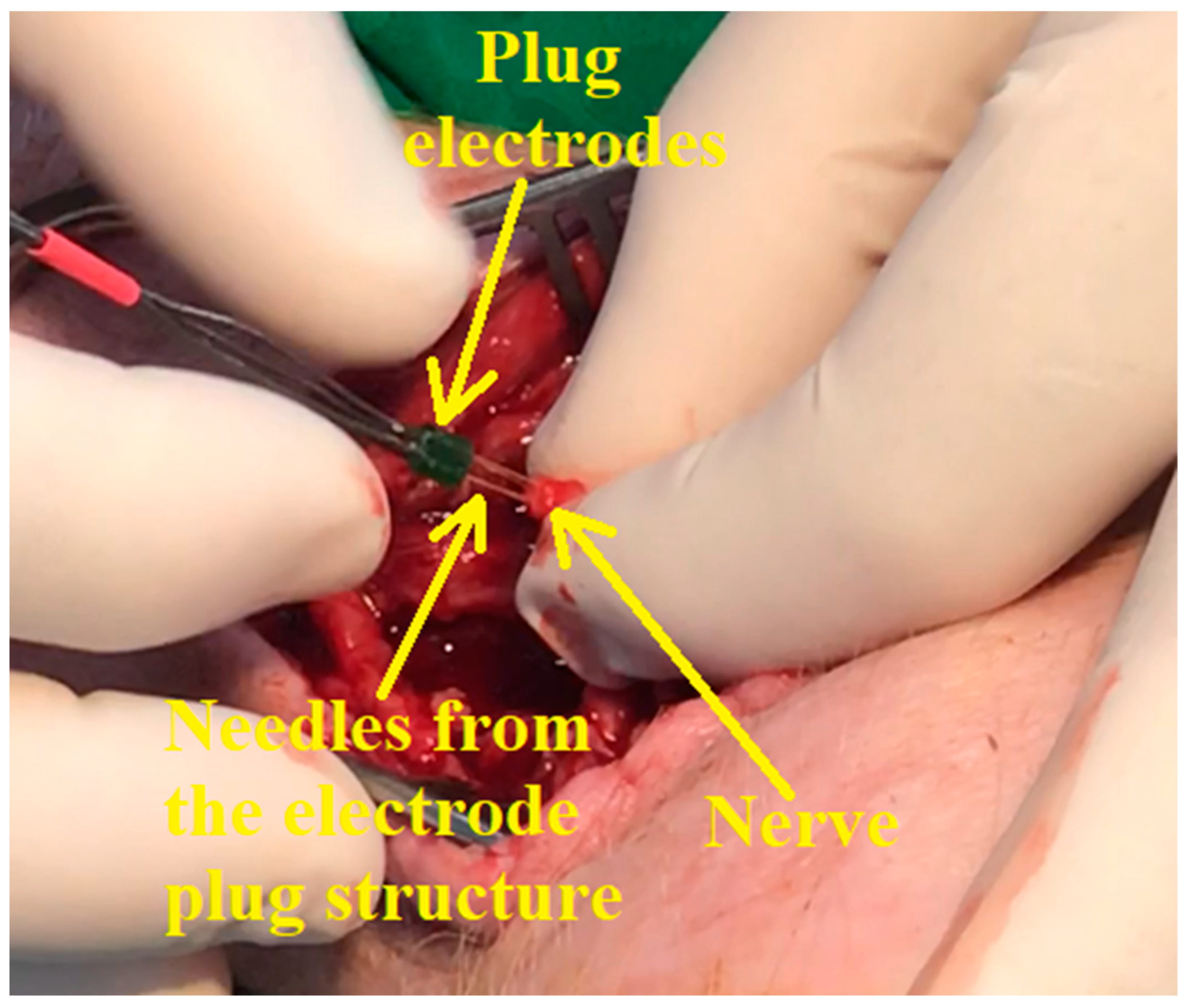 Biosensors 14 00031 g013