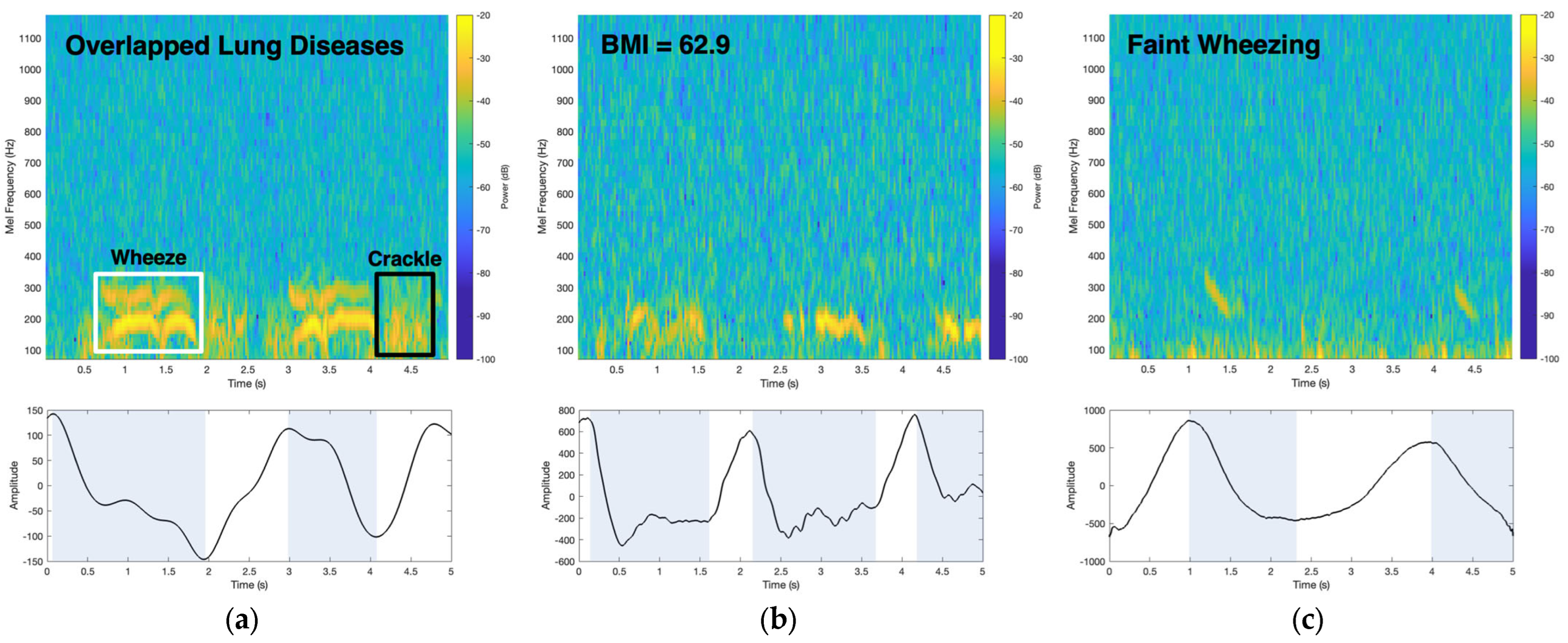 Biosensors 14 00118 g007