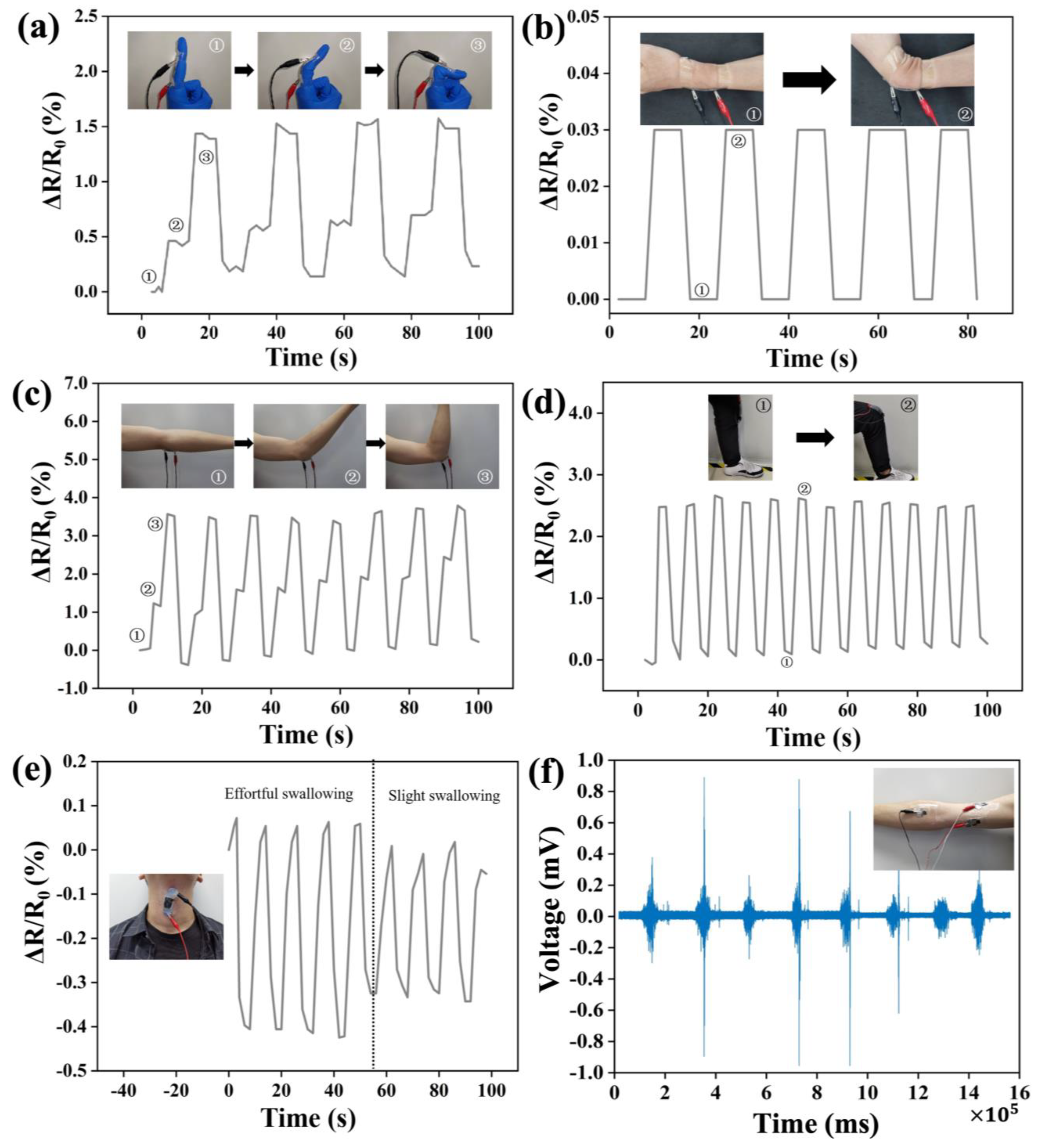 Biosensors 14 00186 g003 Biosensors 14 00186 g003