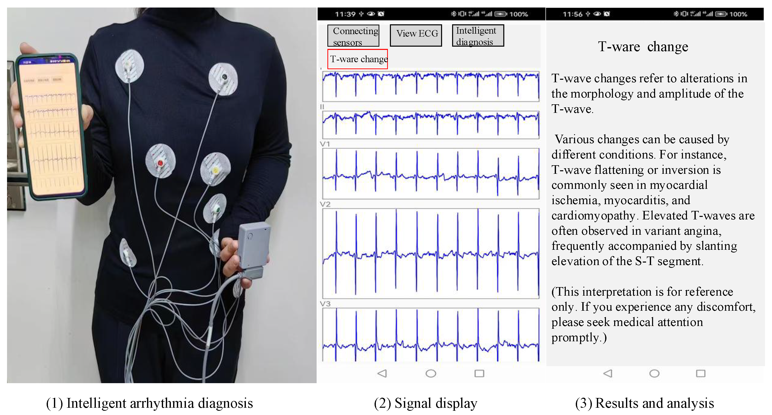 Biosensors 14 00201 g009