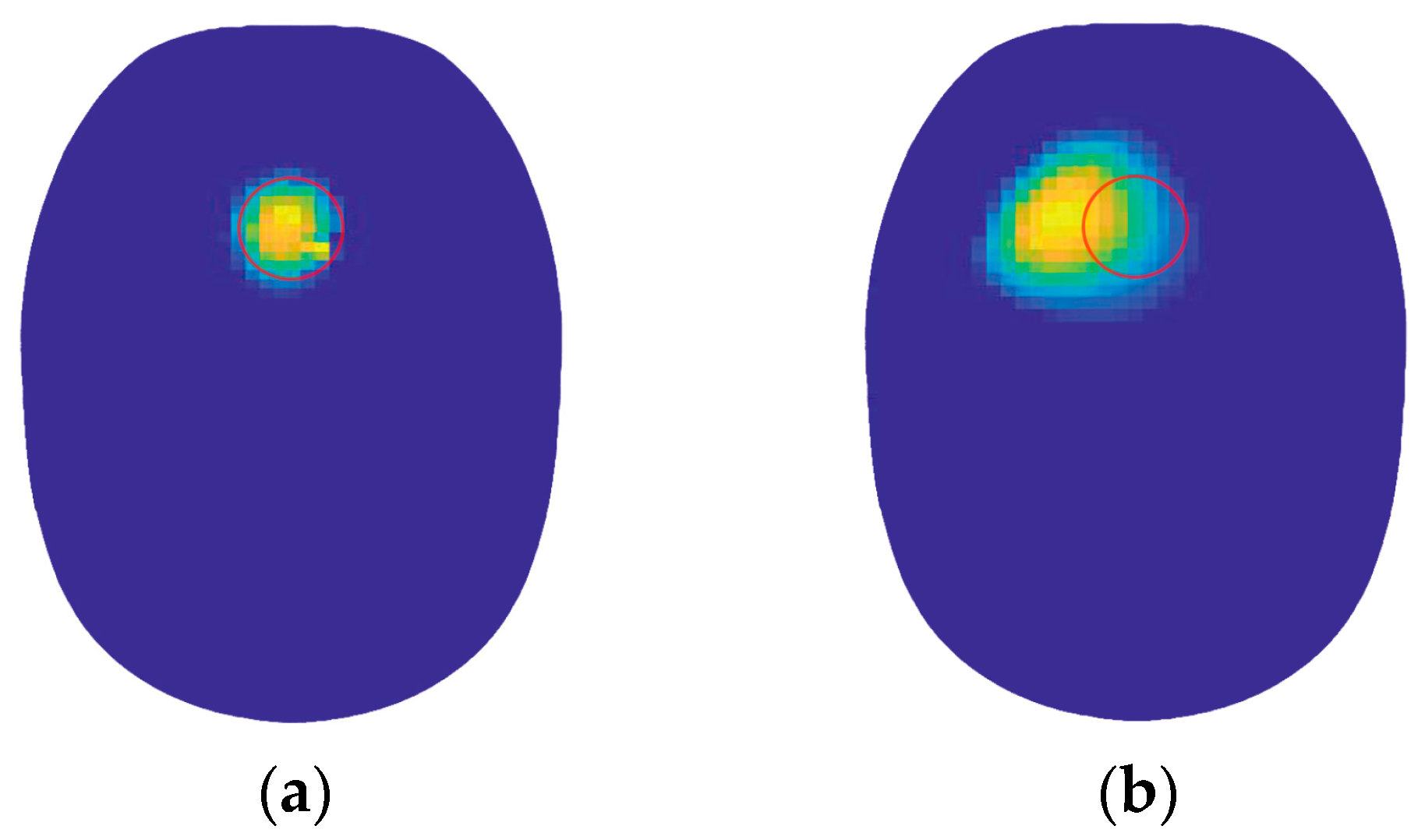 Biosensors 14 00217 g017