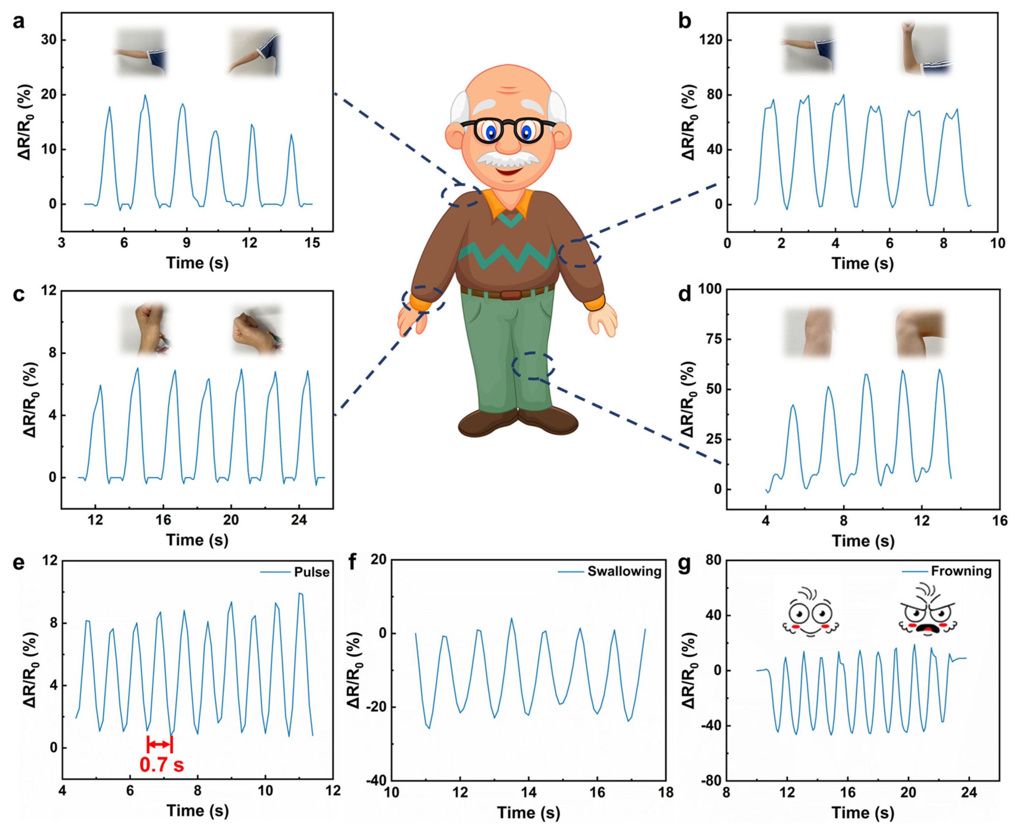 Biosensors 14 00227 g005