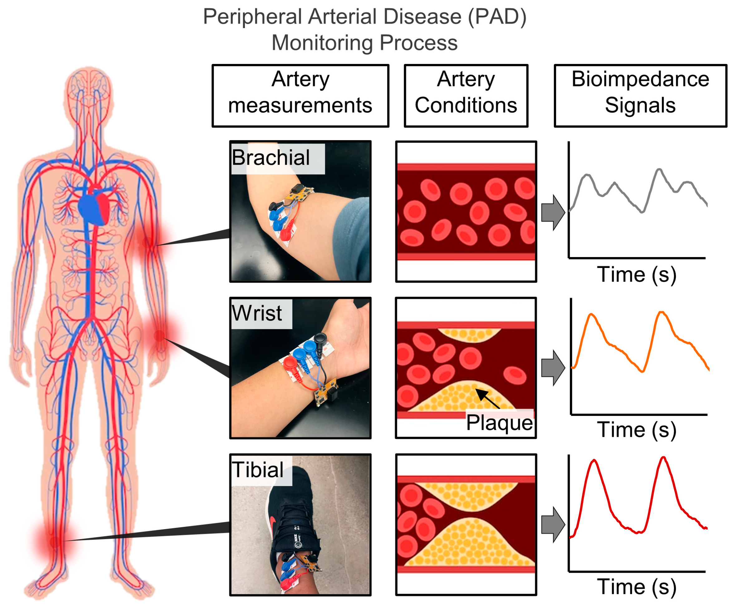 Biosensors 14 00286 g003 Biosensors 14 00286 g003