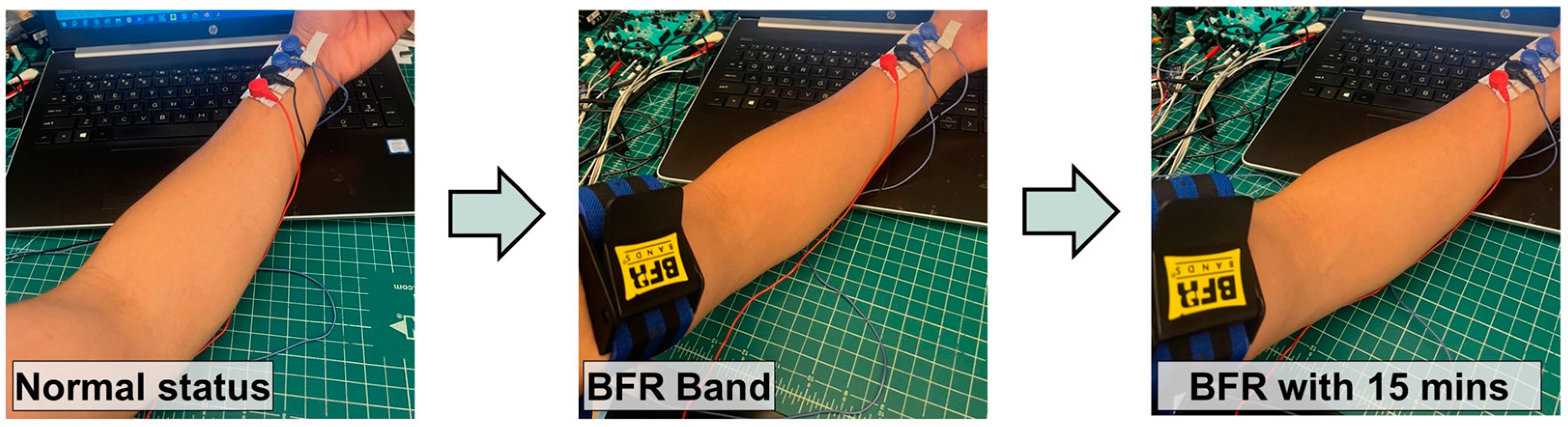 Biosensors 14 00286 g012 Biosensors 14 00286 g012