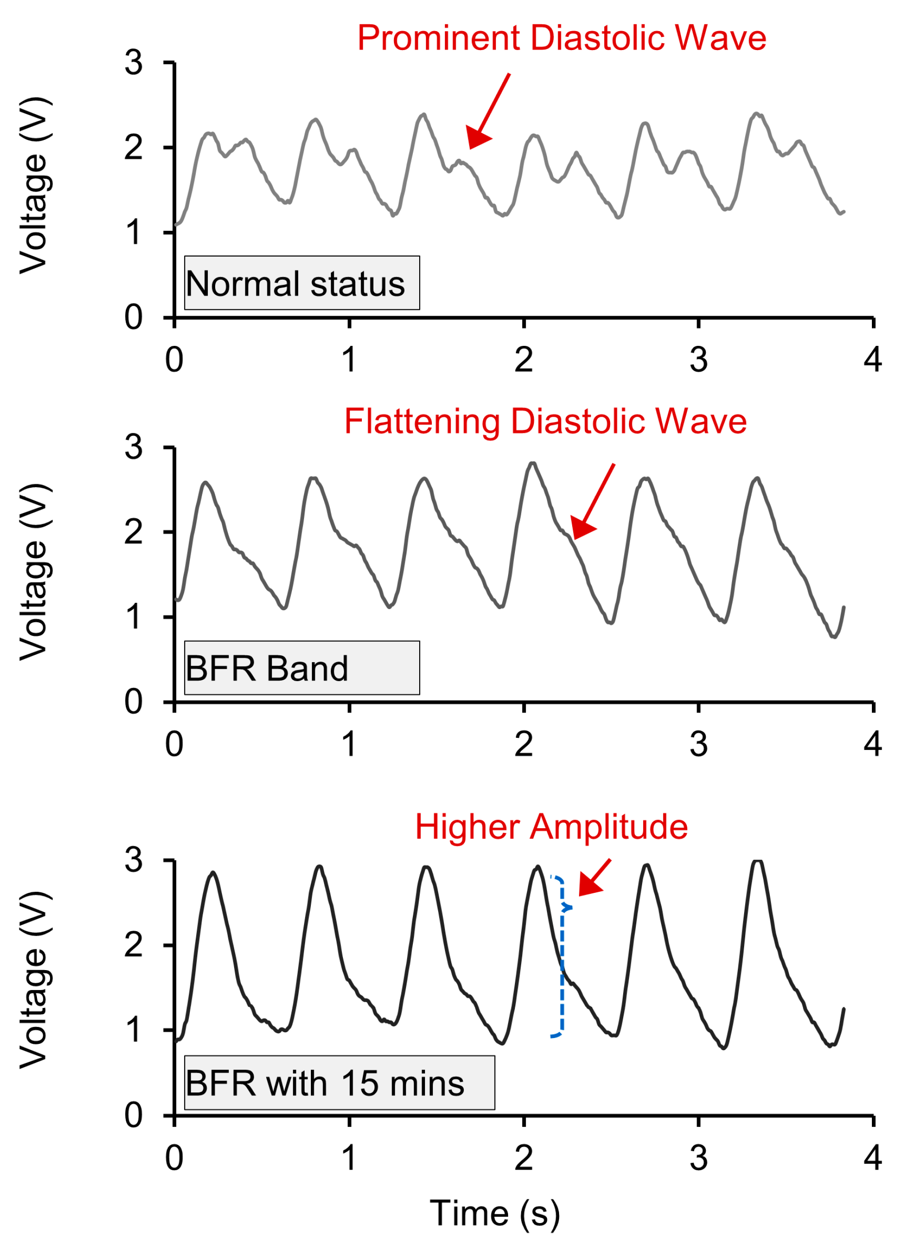 Biosensors 14 00286 g013 Biosensors 14 00286 g013