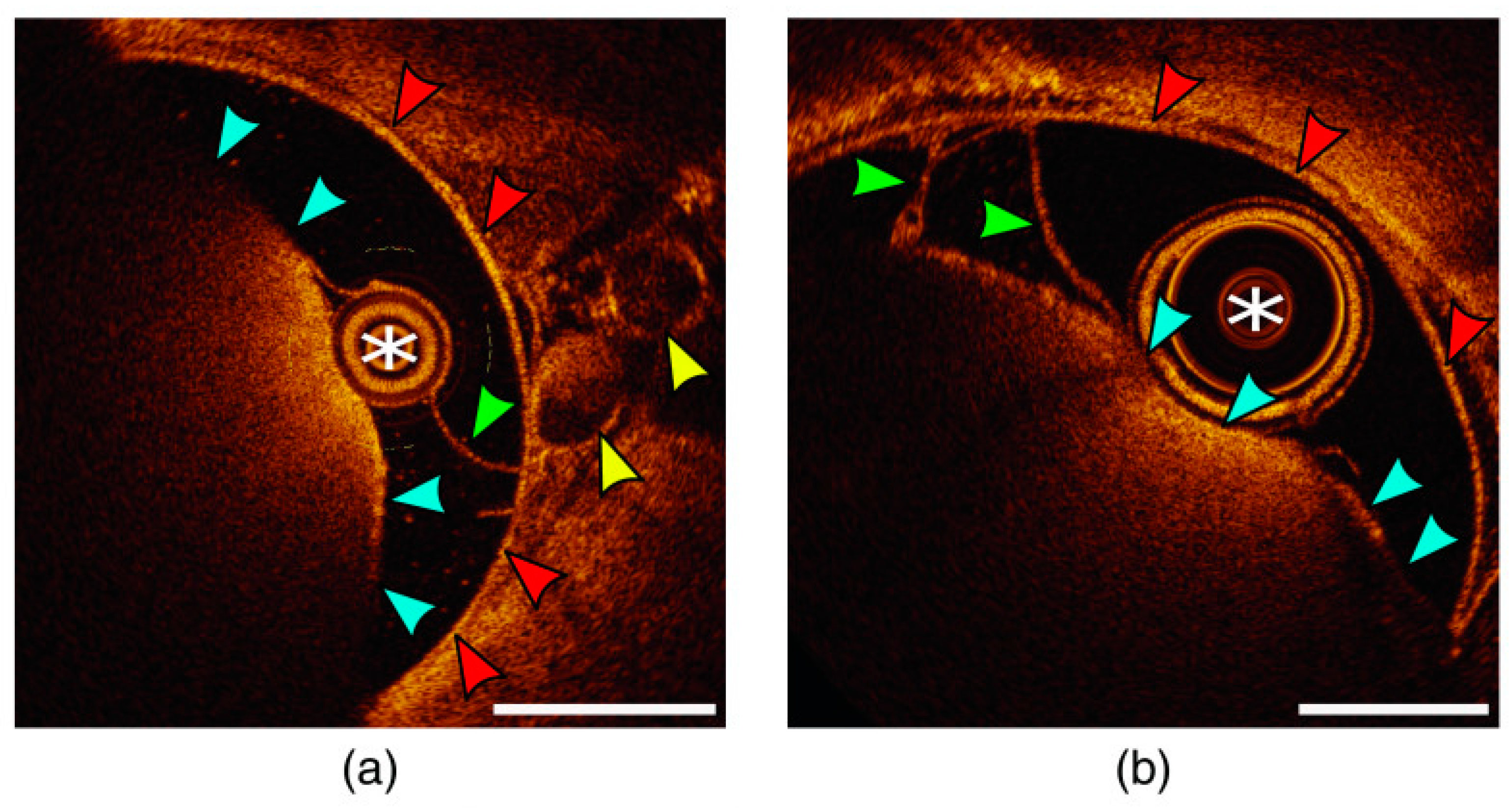 Biosensors 14 00296 g004