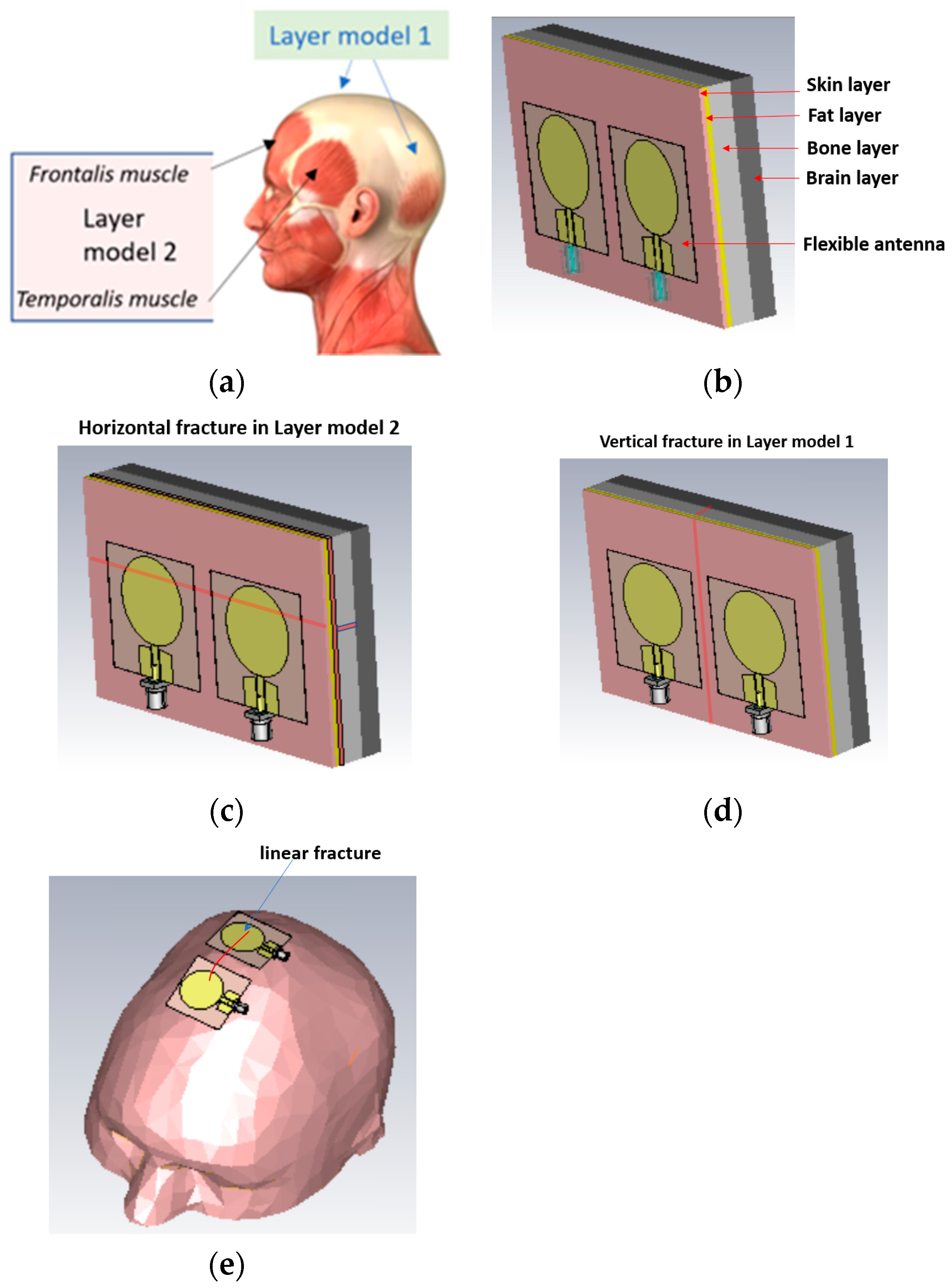 Biosensors 14 00434 g003