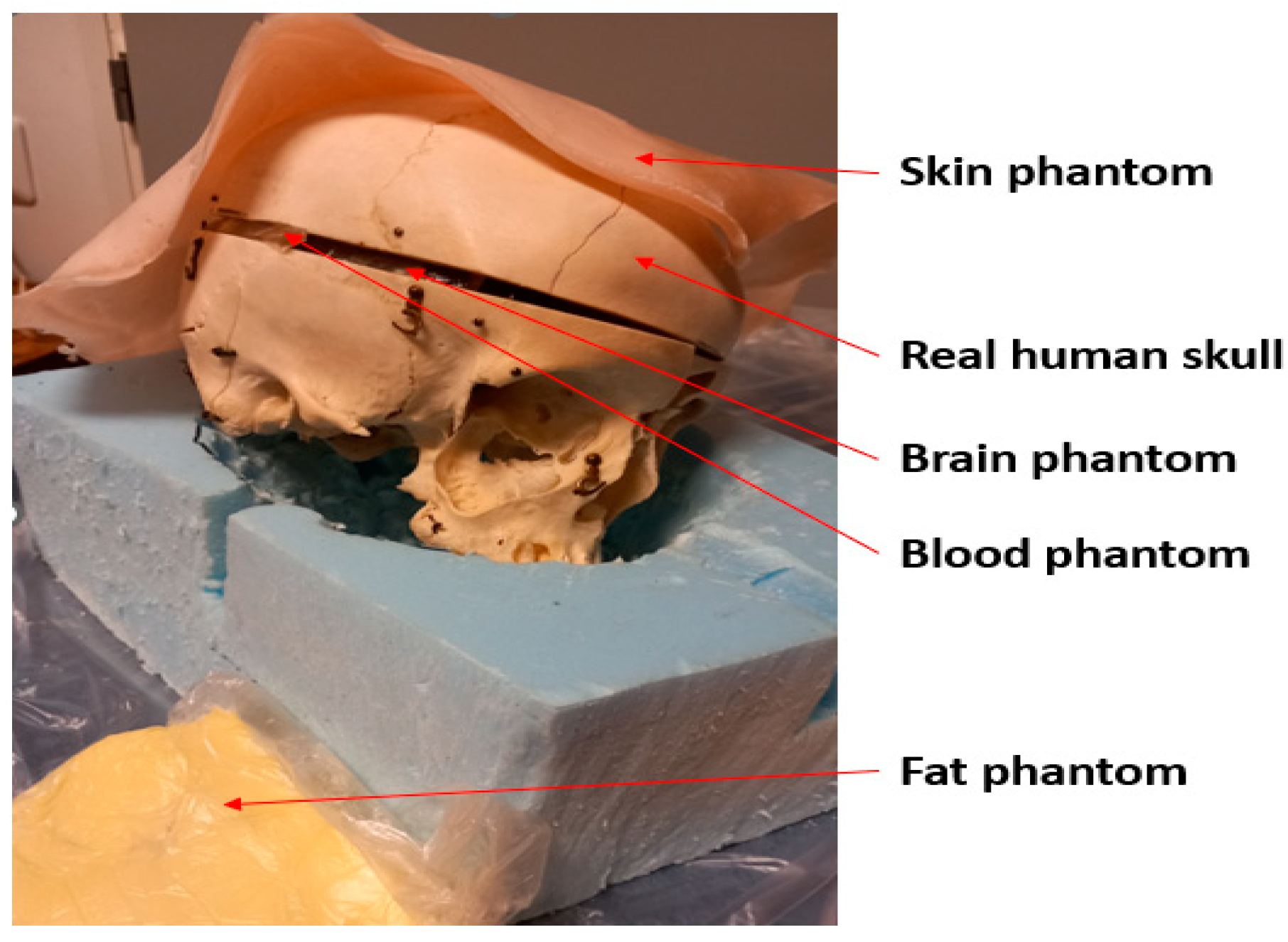 Biosensors 14 00434 g004