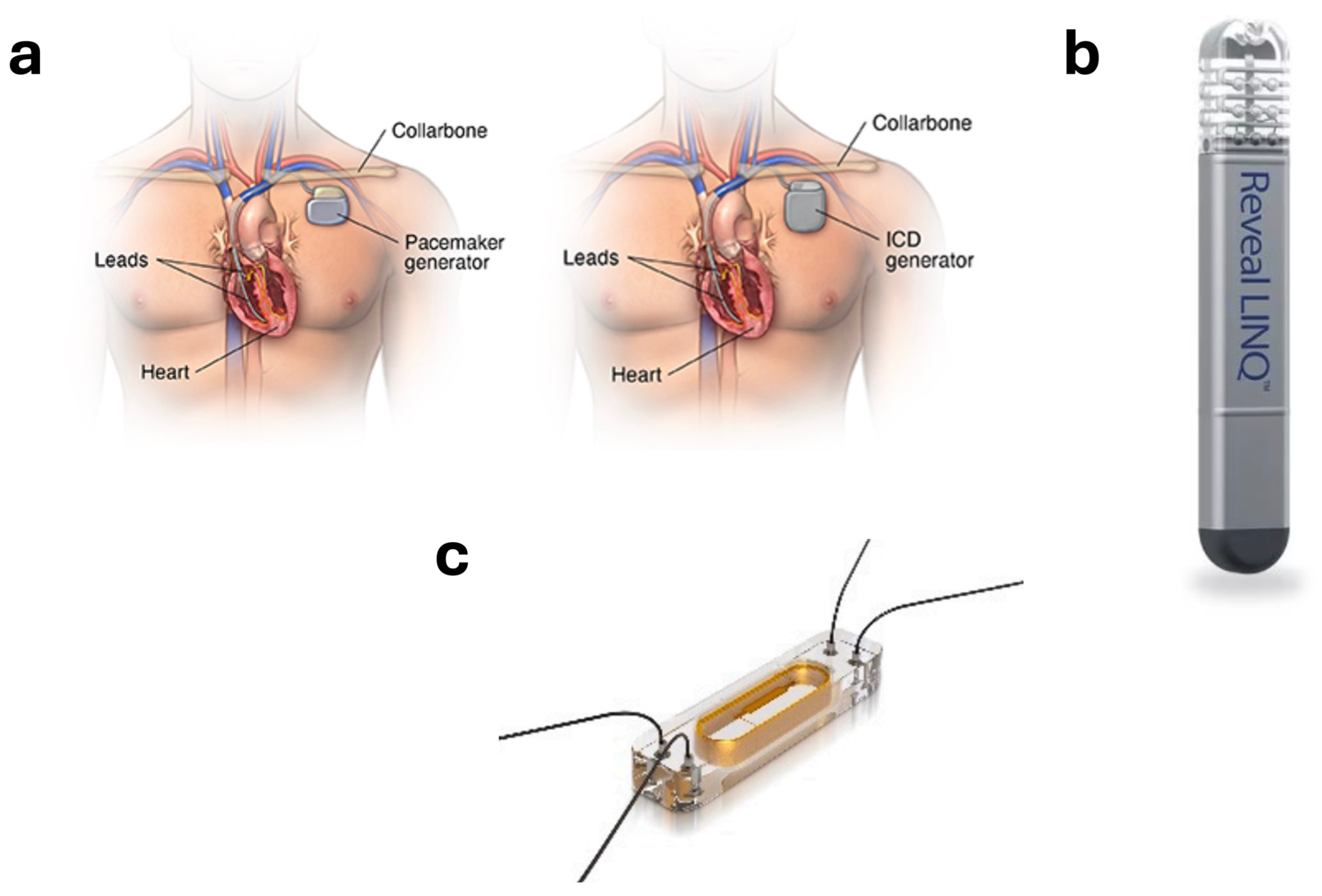 Advances in Cardiovascular Wearable Devices