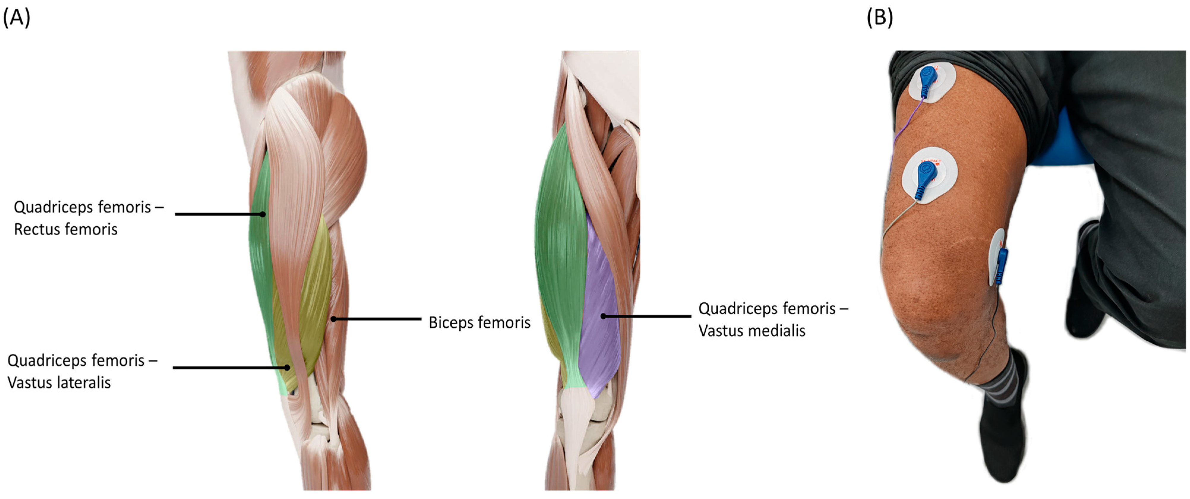 Biosensors 14 00553 g003