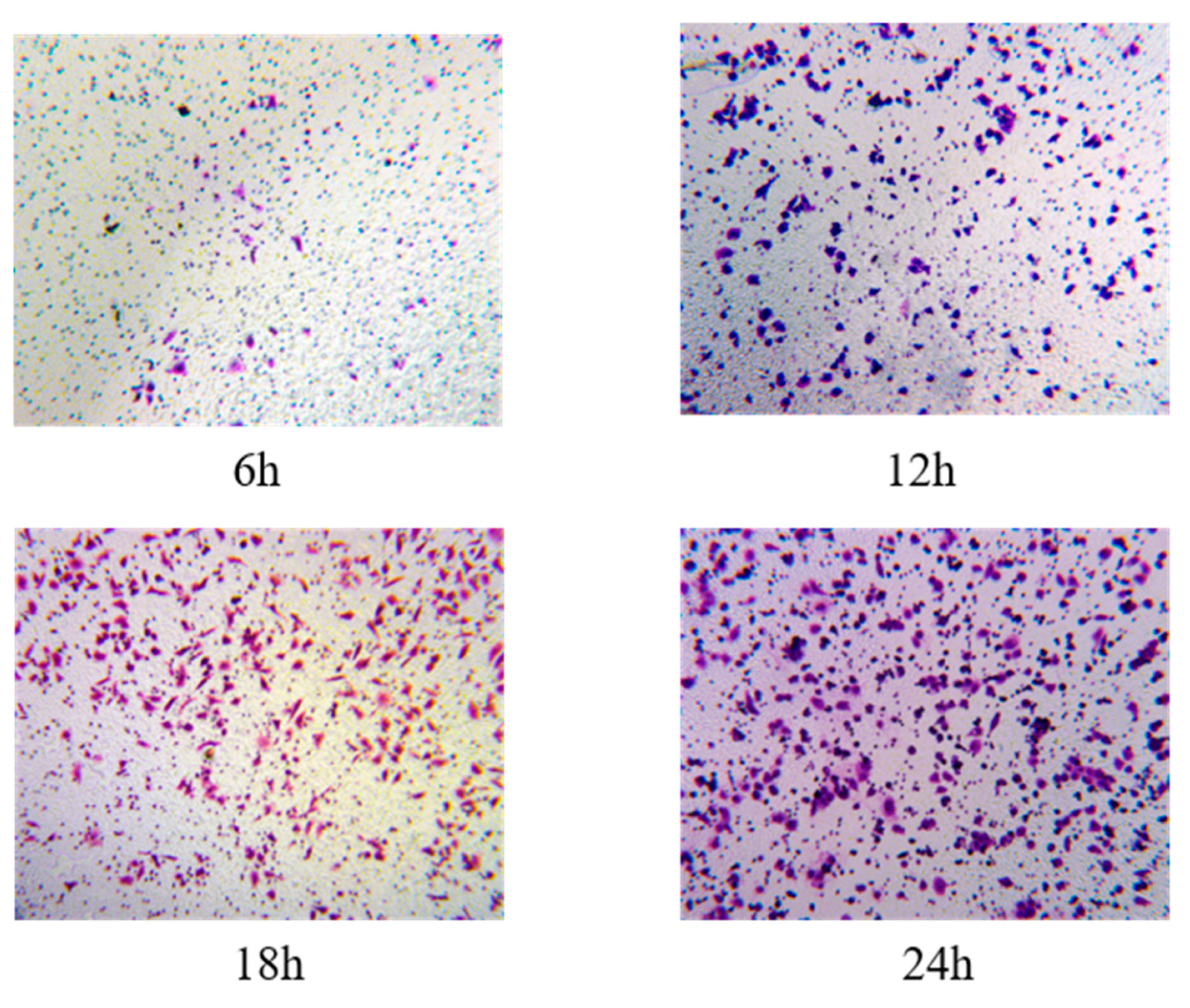 Biosensors 15 00091 g0a2