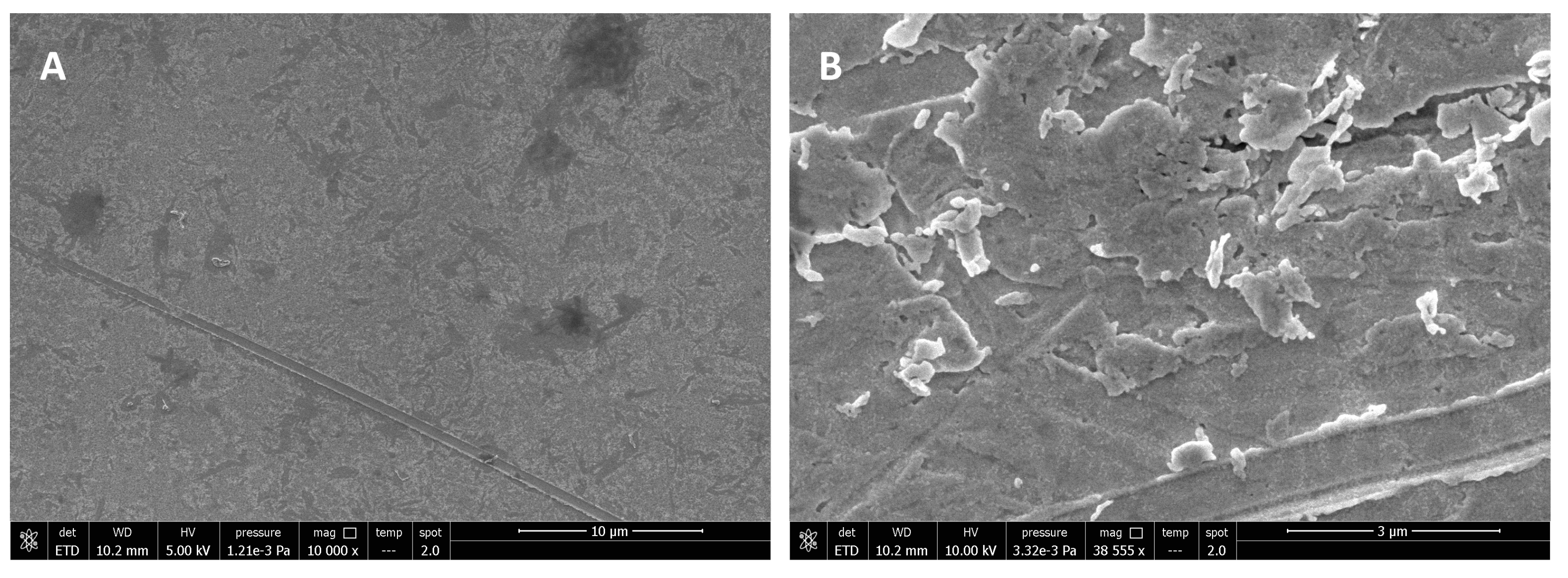 Biosensors 15 00146 g011