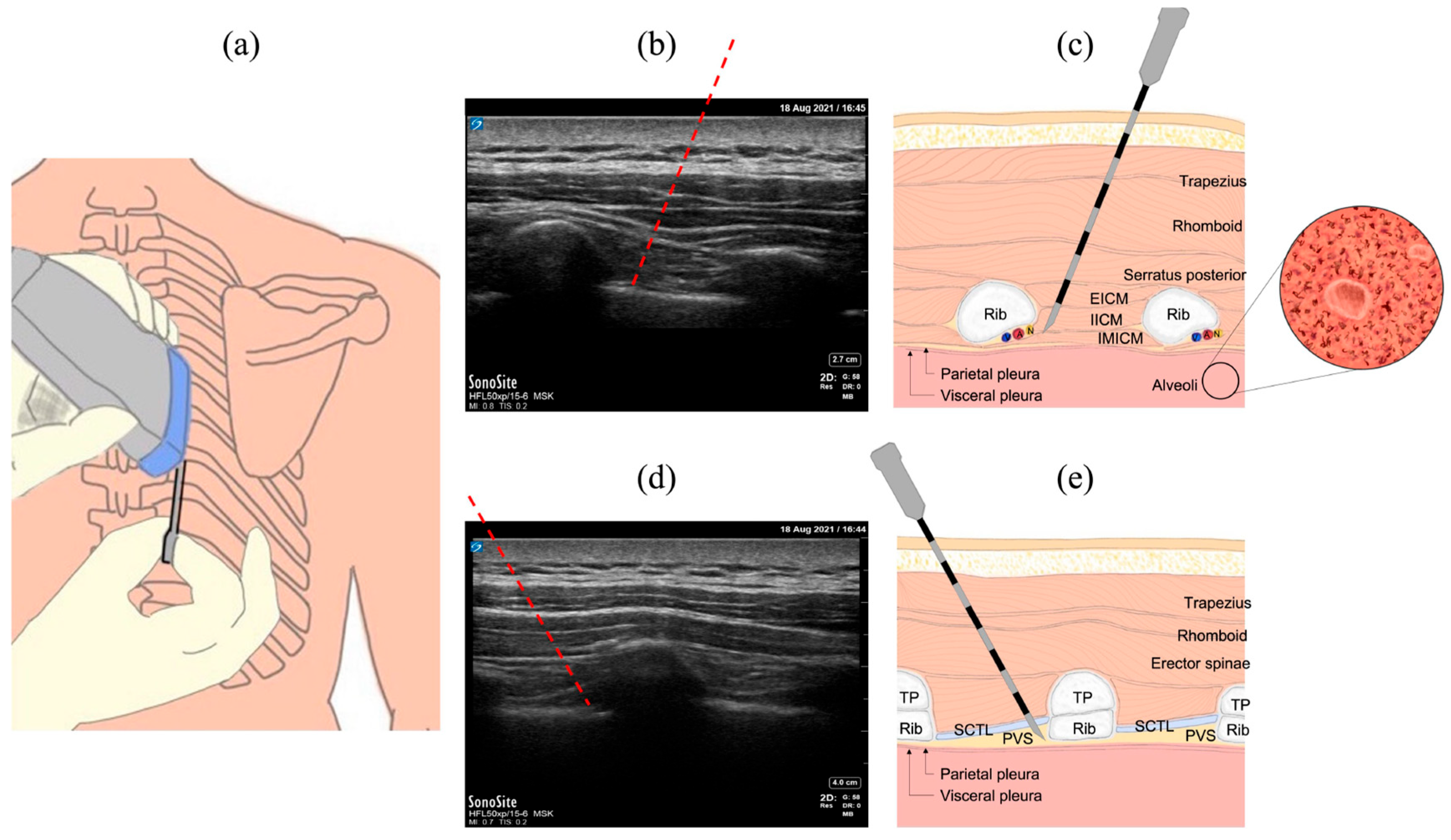 Biosensors 15 00201 g001