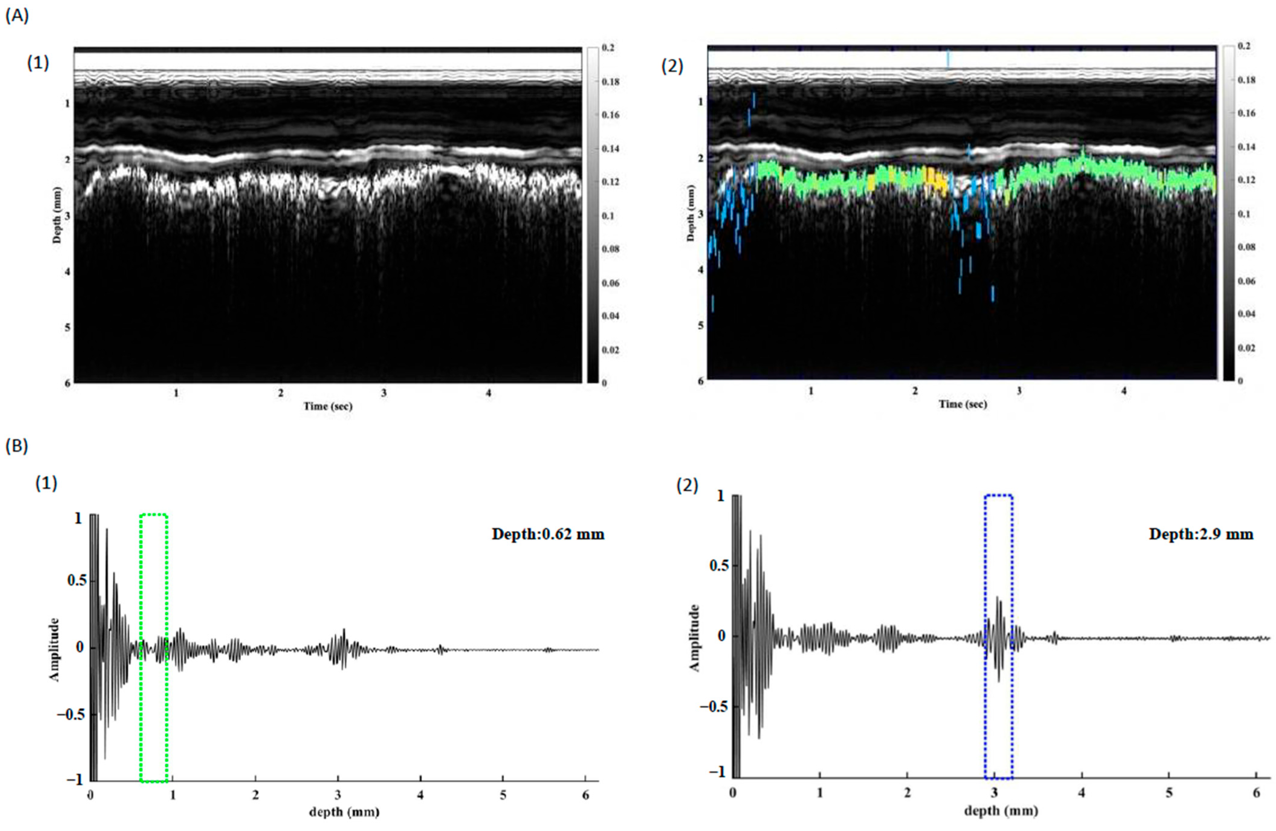 Biosensors 15 00201 g006