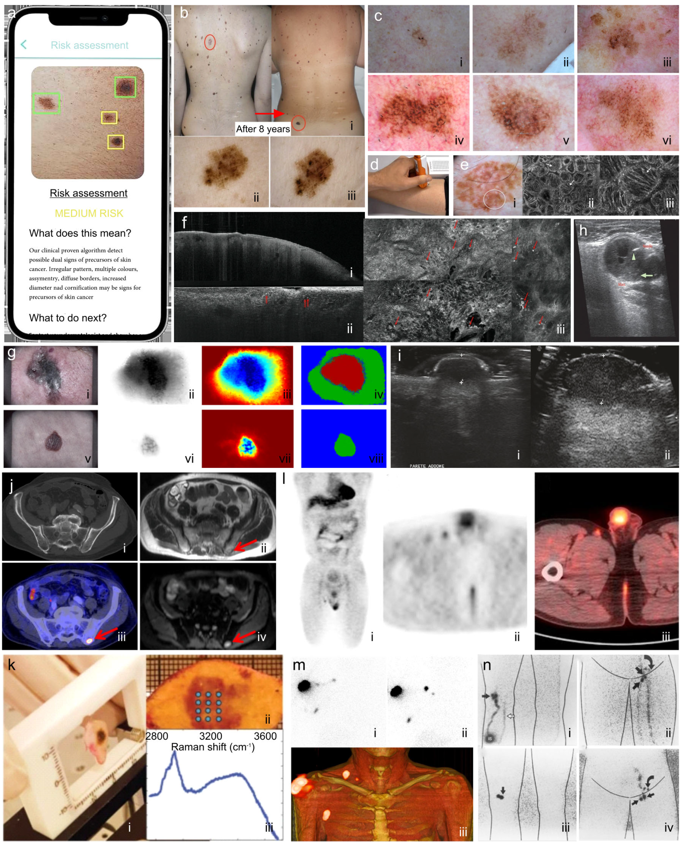 Biosensors 15 00297 g003