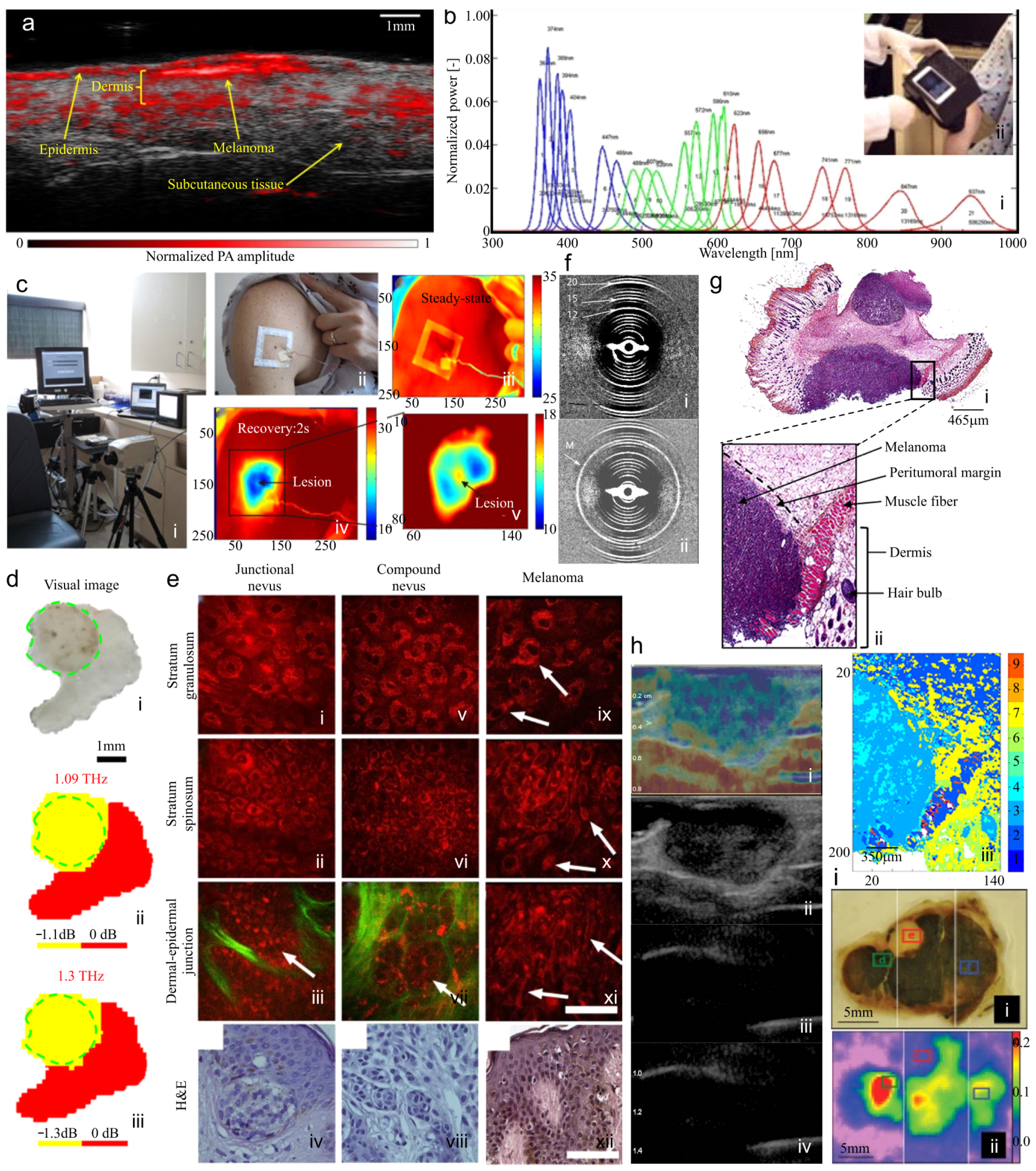 Biosensors 15 00297 g004
