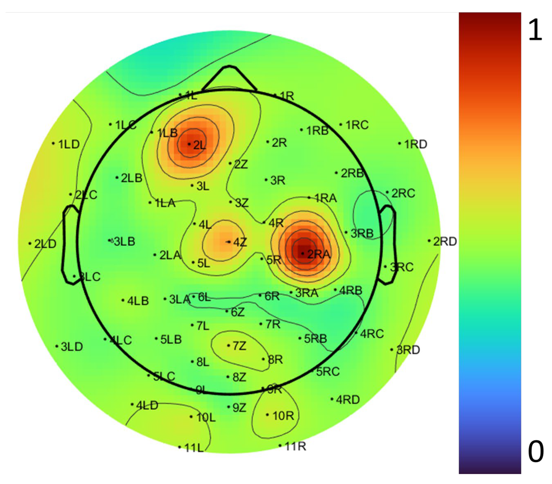 Biosensors 15 00314 g020