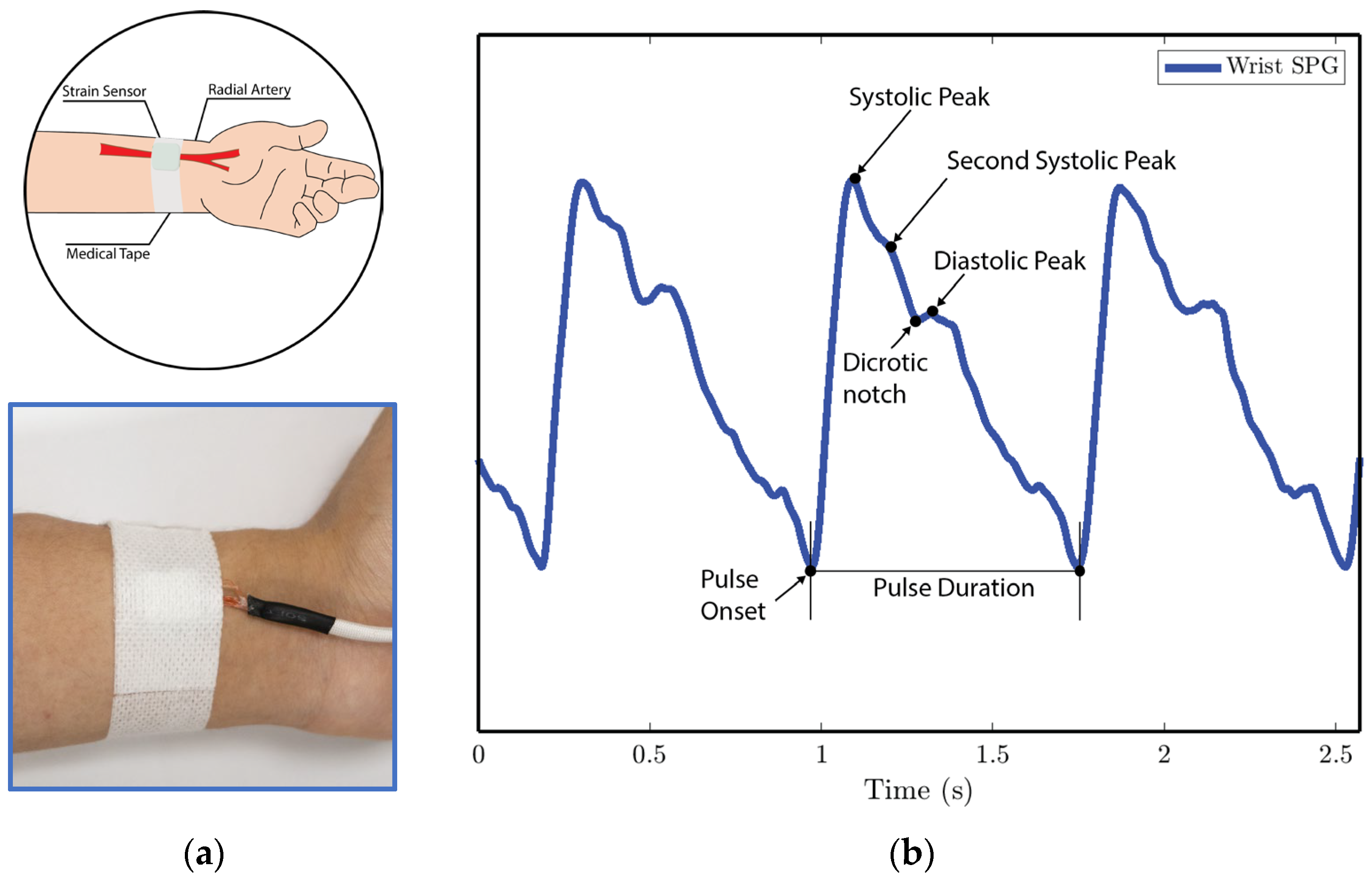 Biosensors 15 00325 g011