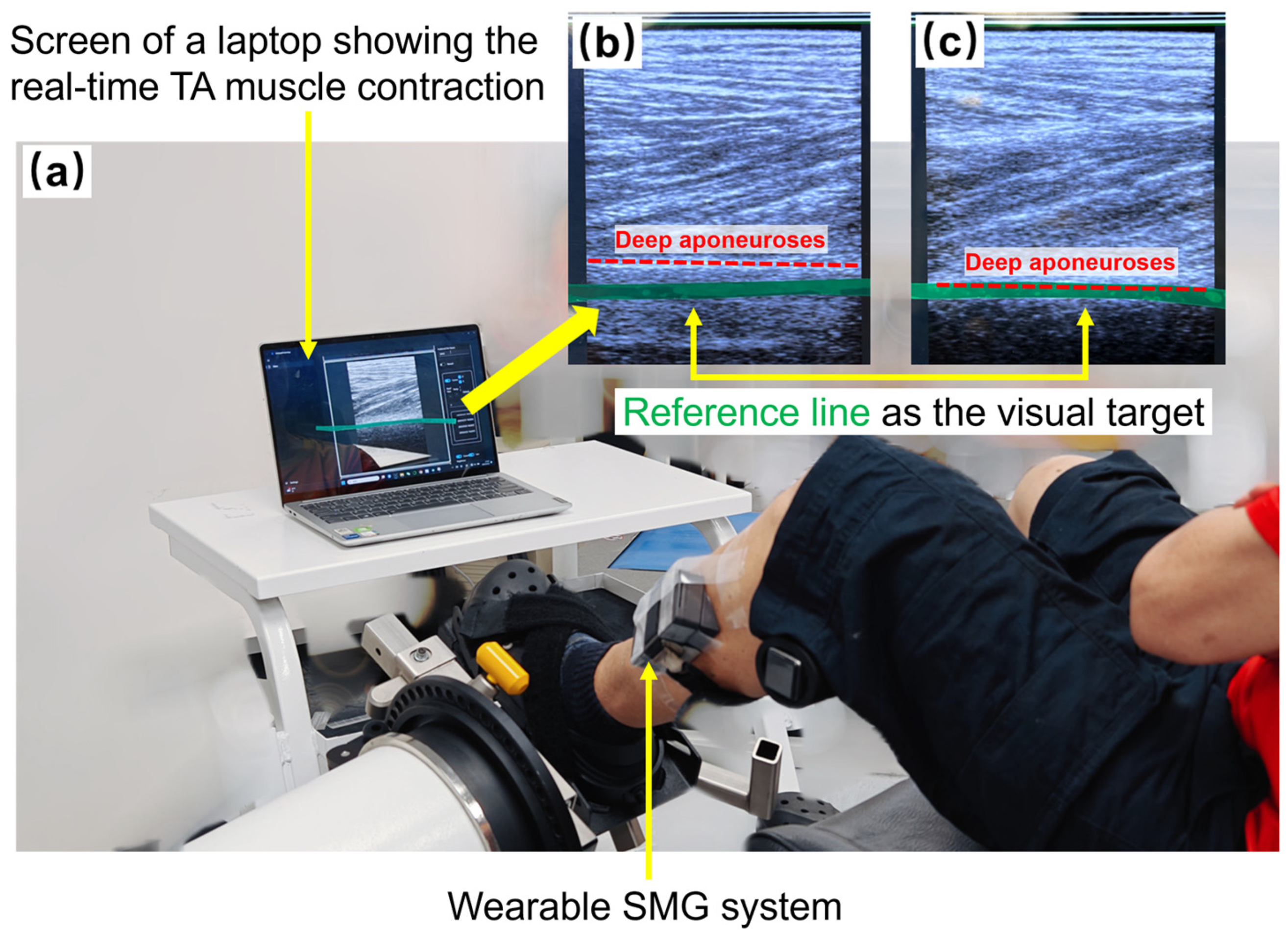 Biosensors 15 00365 g001 Biosensors 15 00365 g001