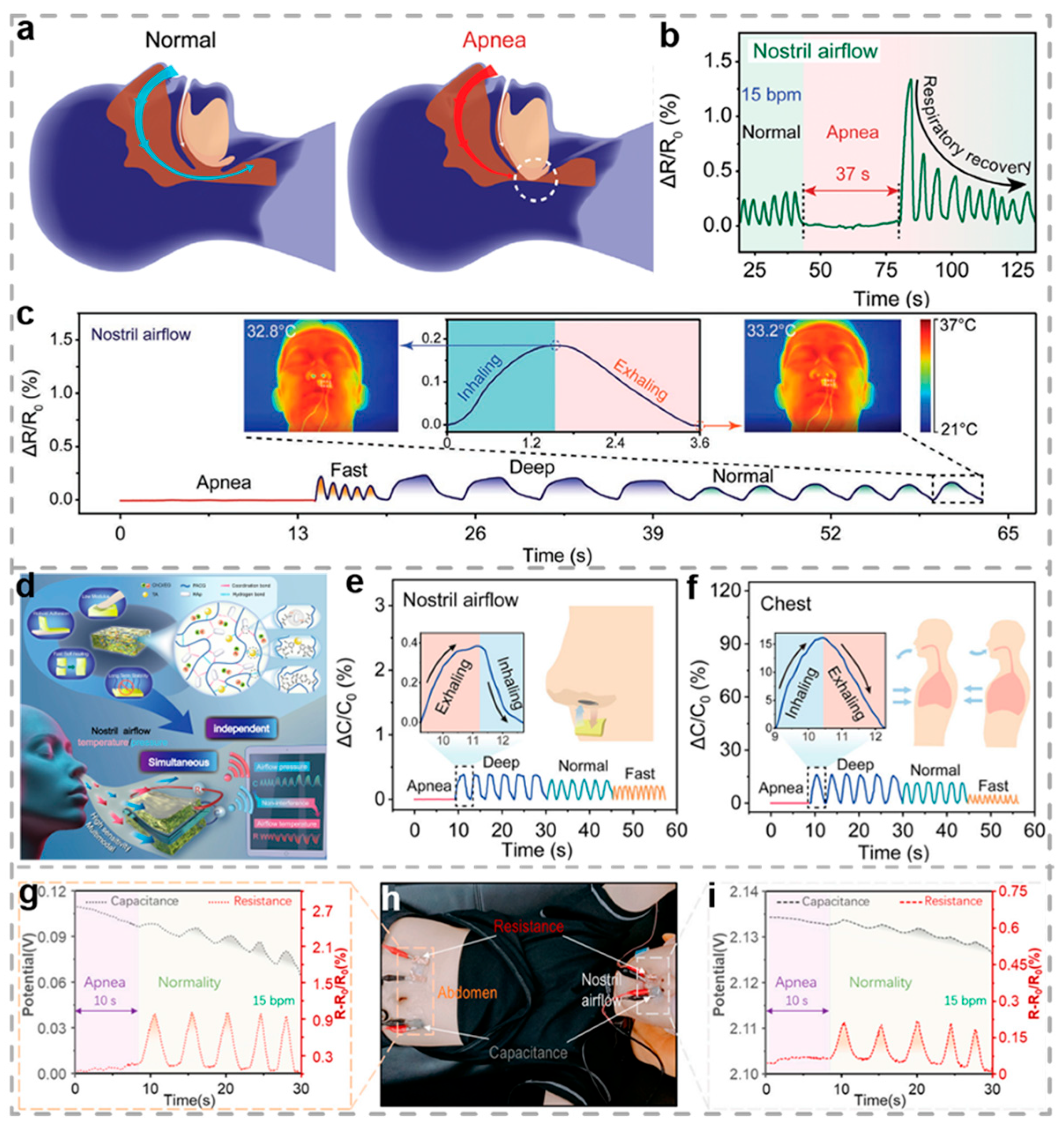 Biosensors 15 00463 g010