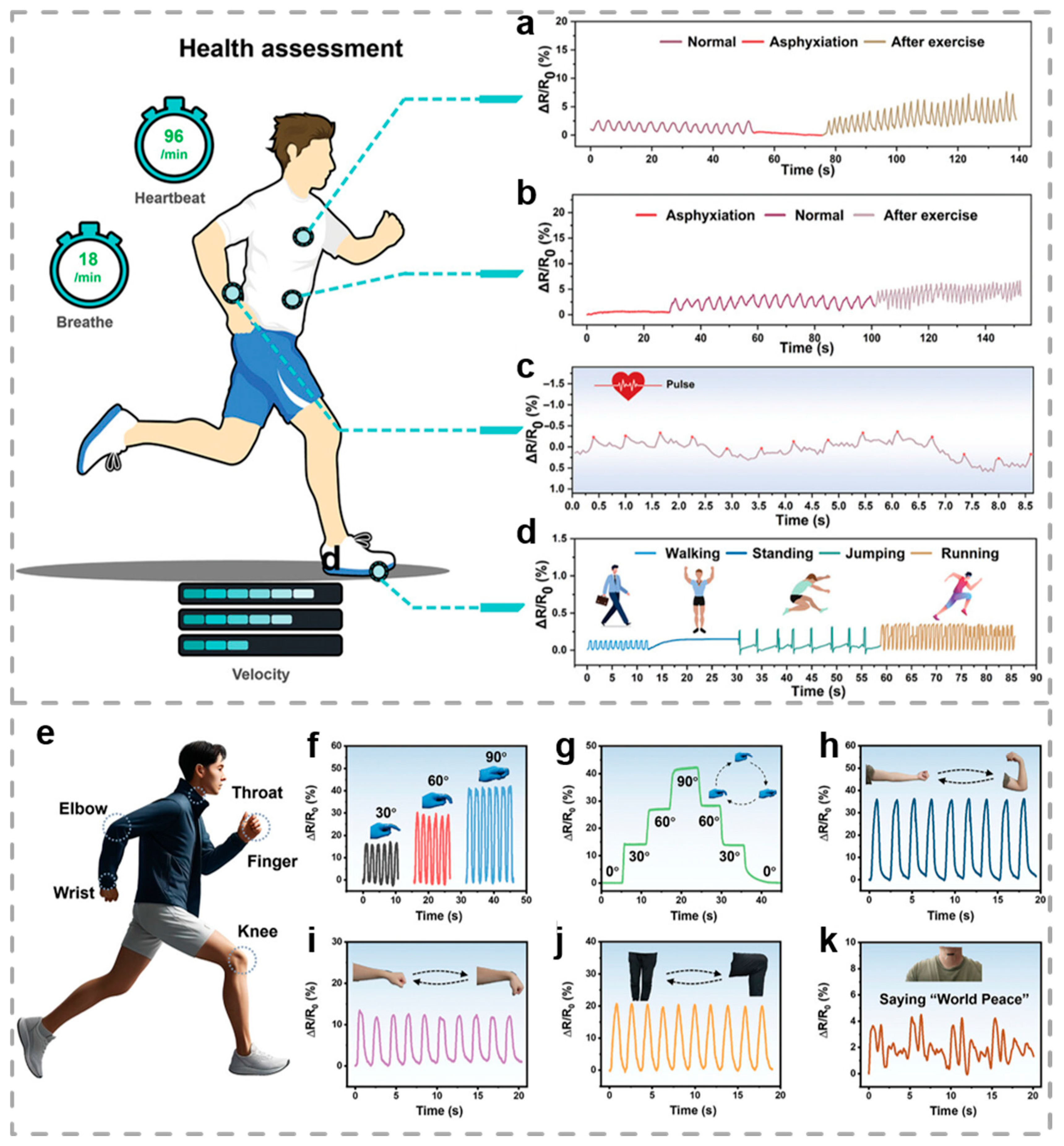 Biosensors 15 00463 g011