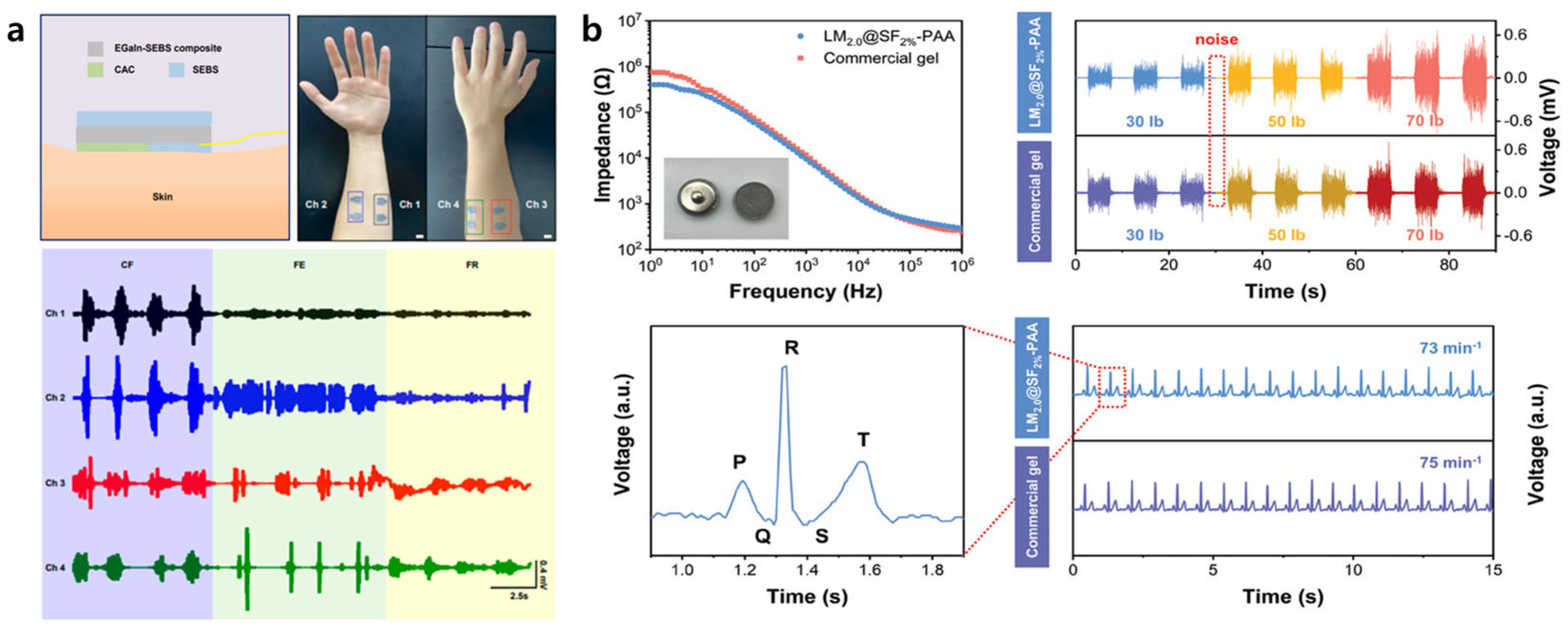Biosensors 15 00466 g004