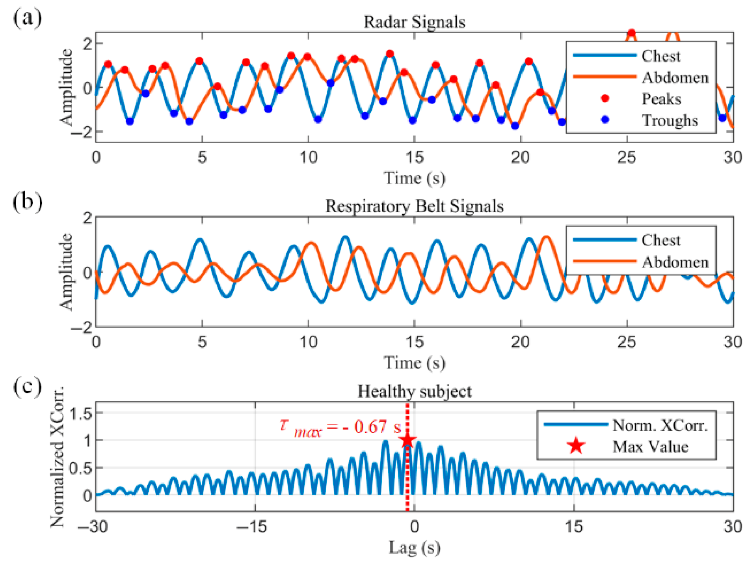 Biosensors 15 00486 g017