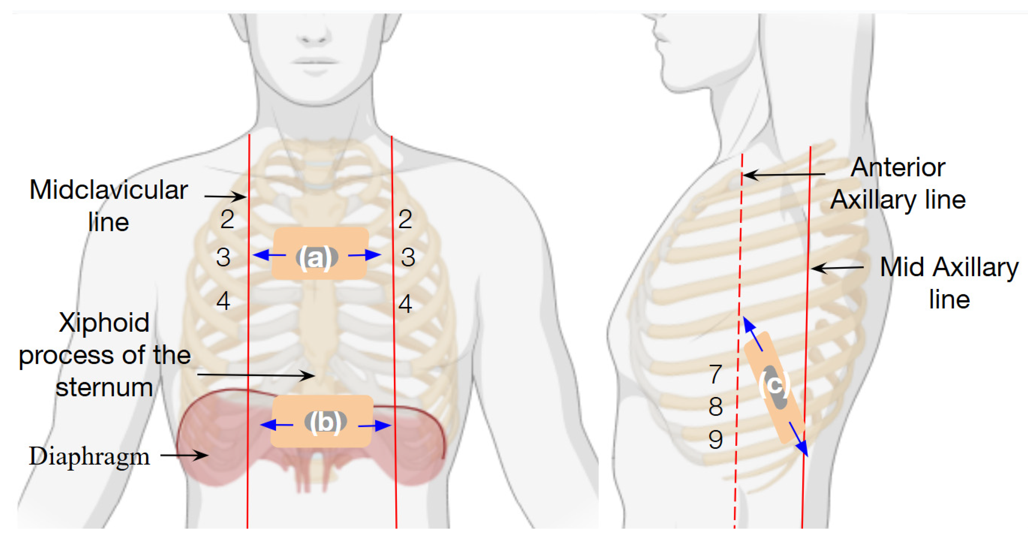 Biosensors 15 00523 g007
