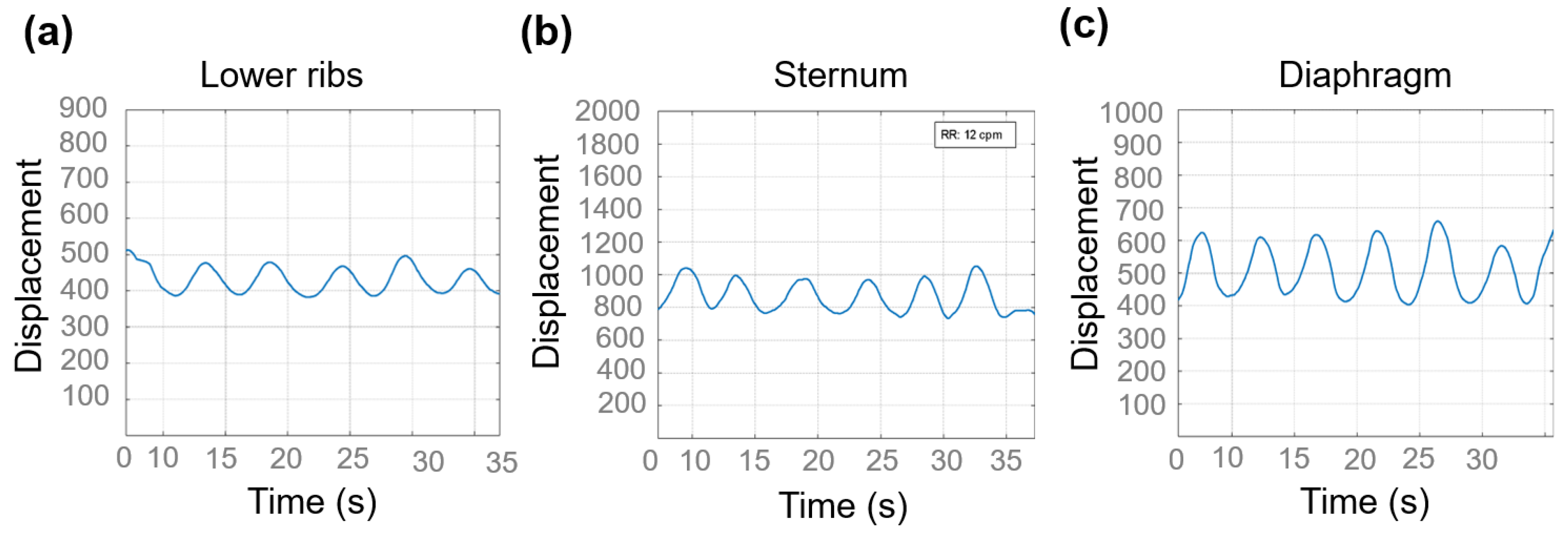 Biosensors 15 00523 g008