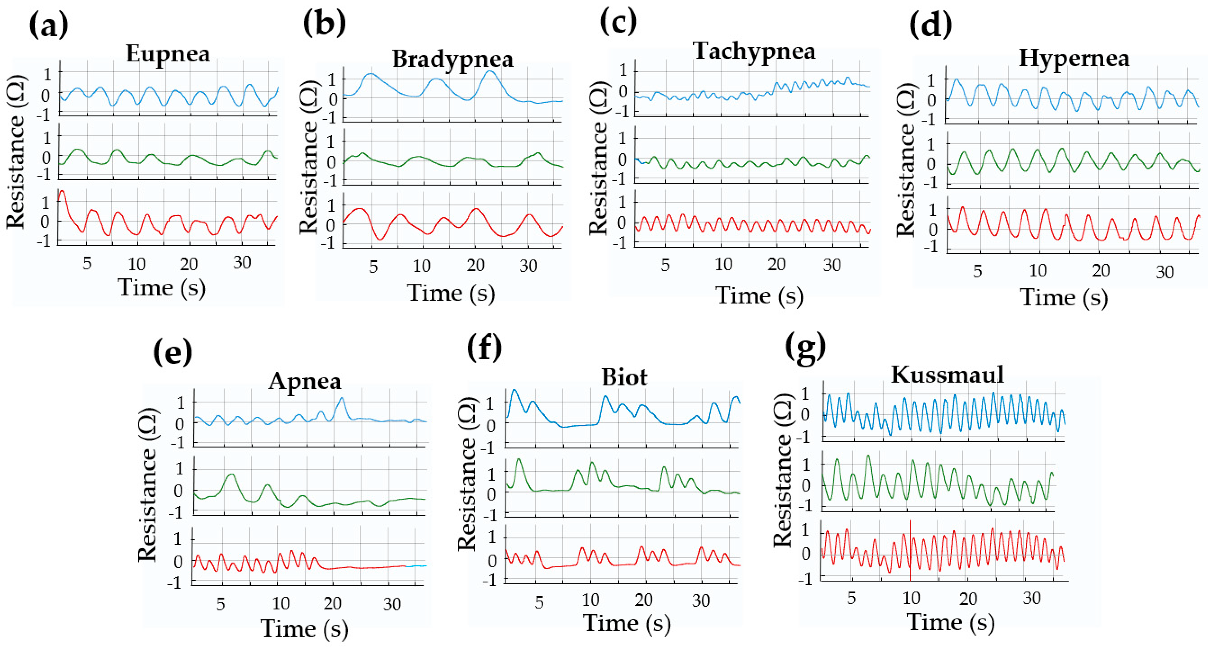 Biosensors 15 00523 g009