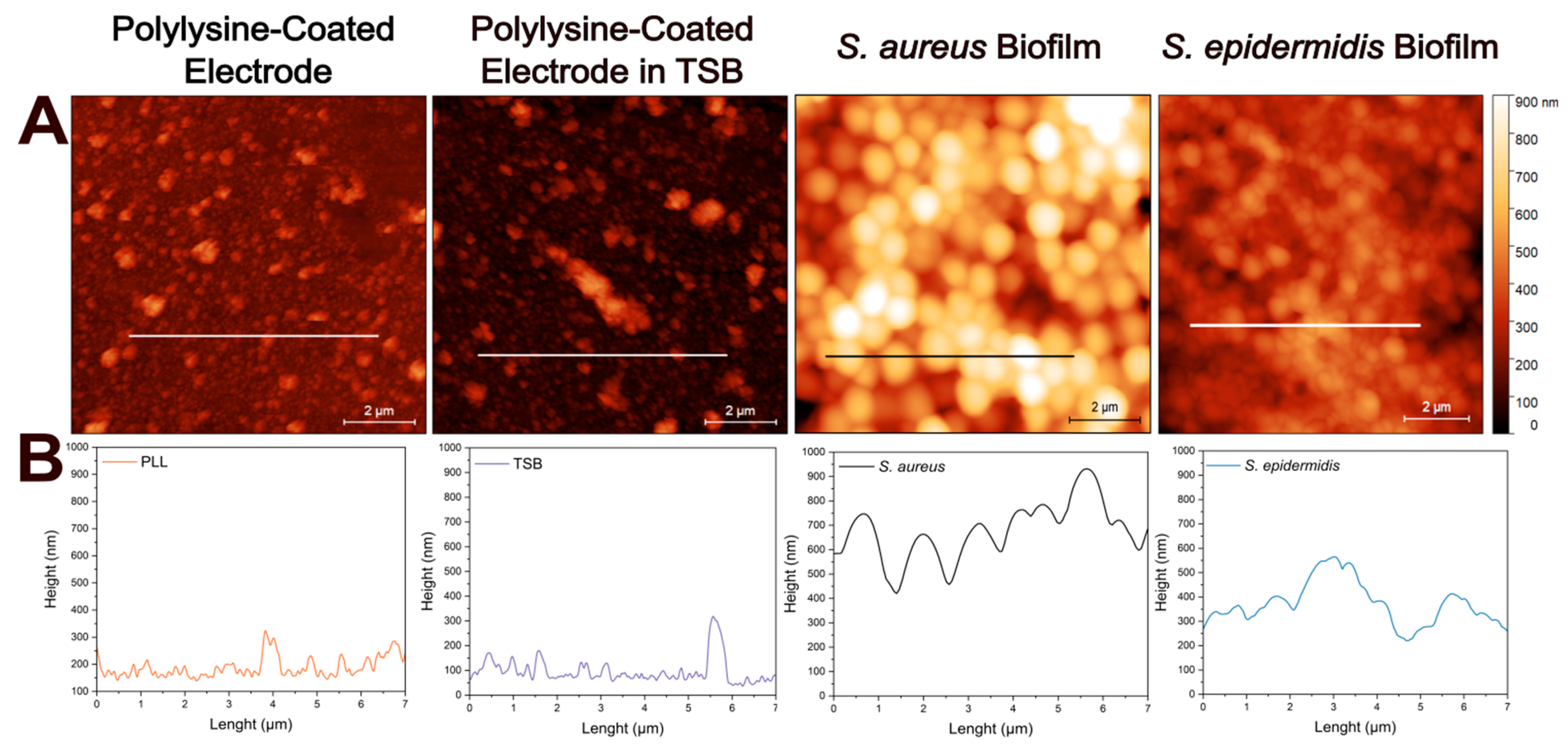 Biosensors 15 00596 g003 Biosensors 15 00596 g003