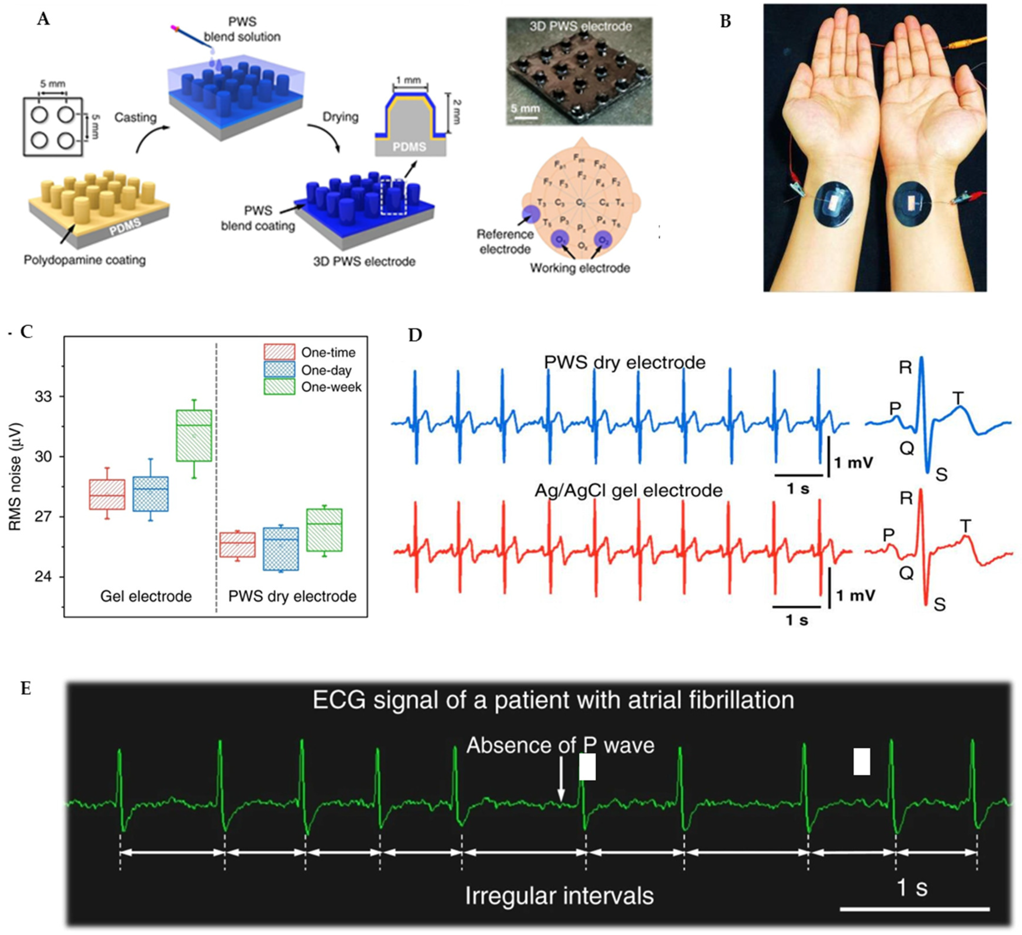 Biosensors 15 00619 g006