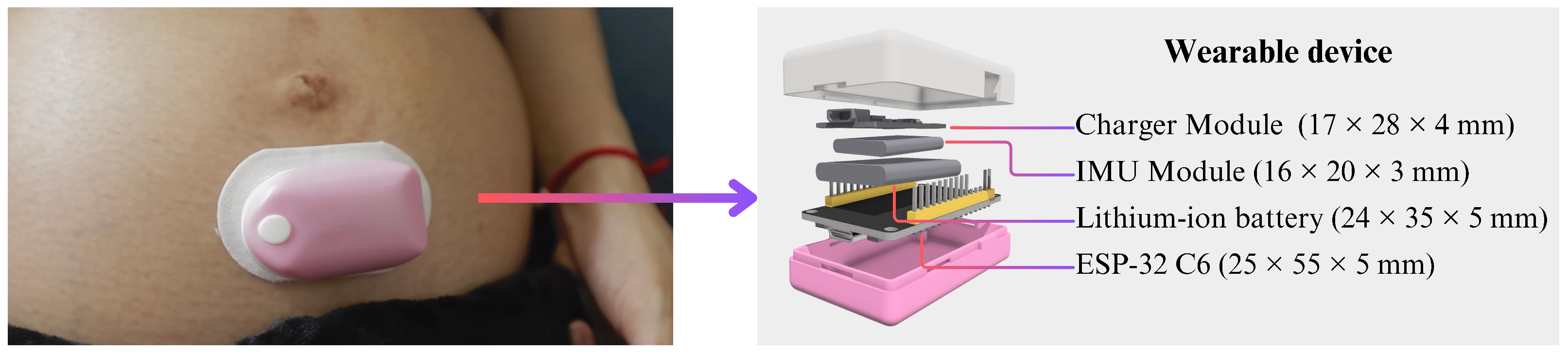 Biosensors 15 00662 g002