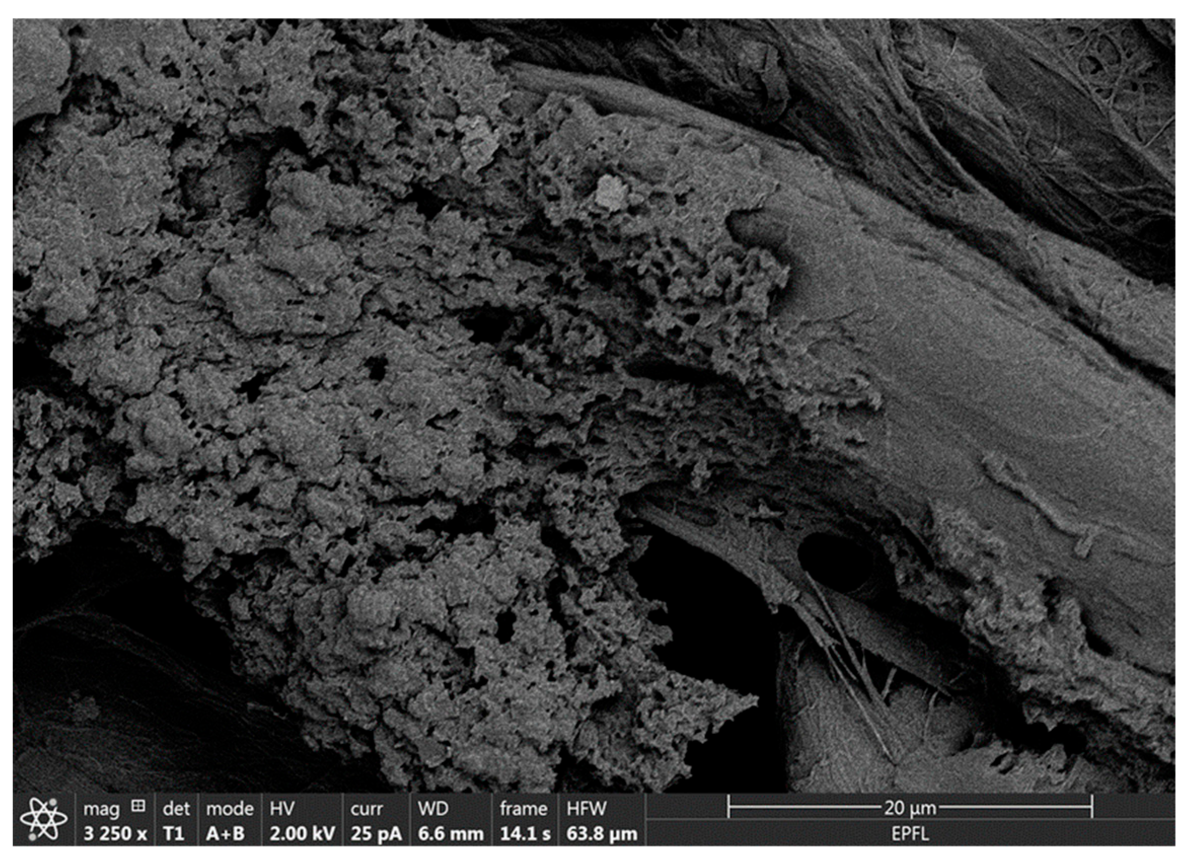 Biosensors 15 00685 g004 Biosensors 15 00685 g004