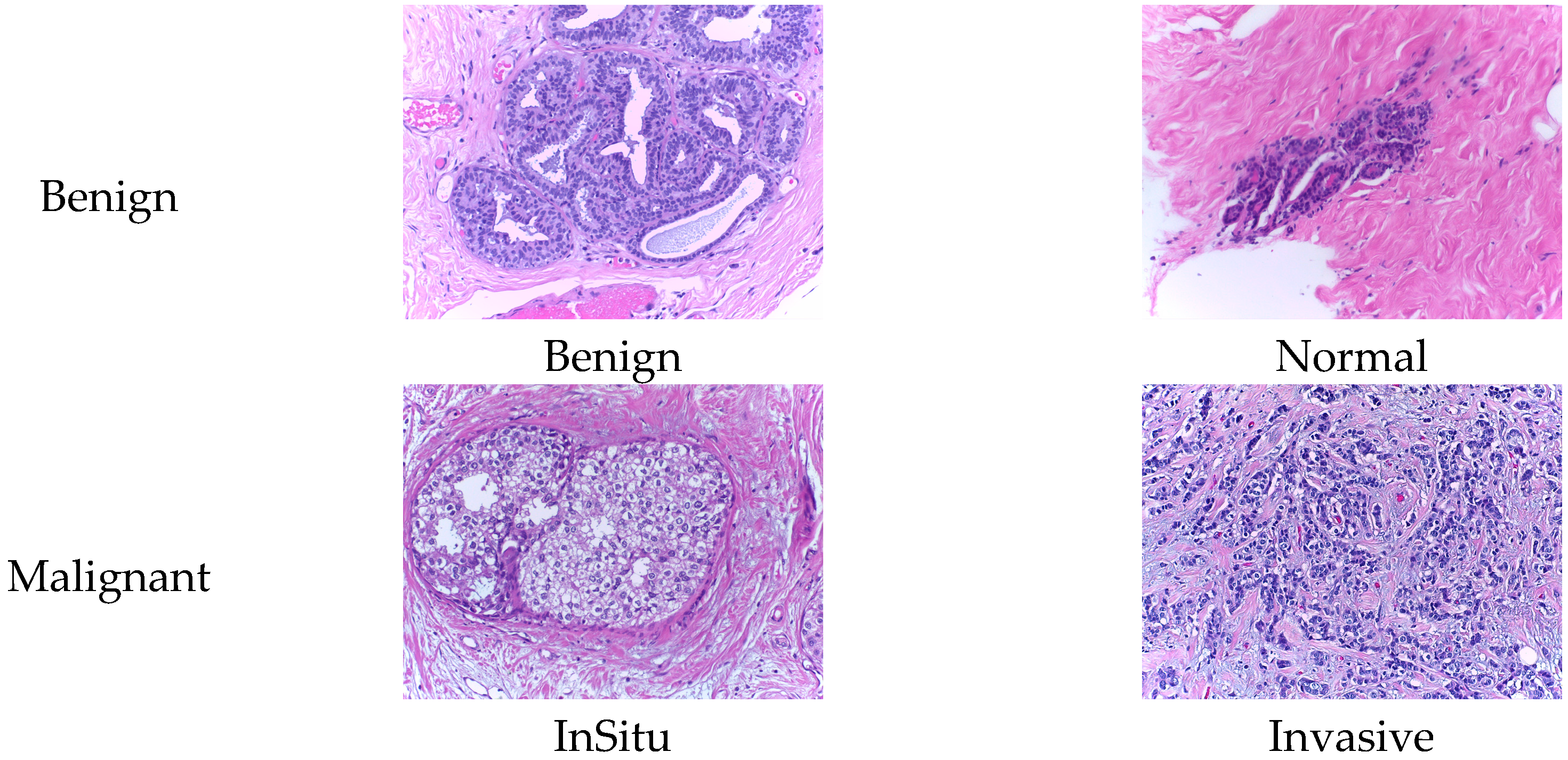Biosensors 15 00718 g002 Biosensors 15 00718 g002
