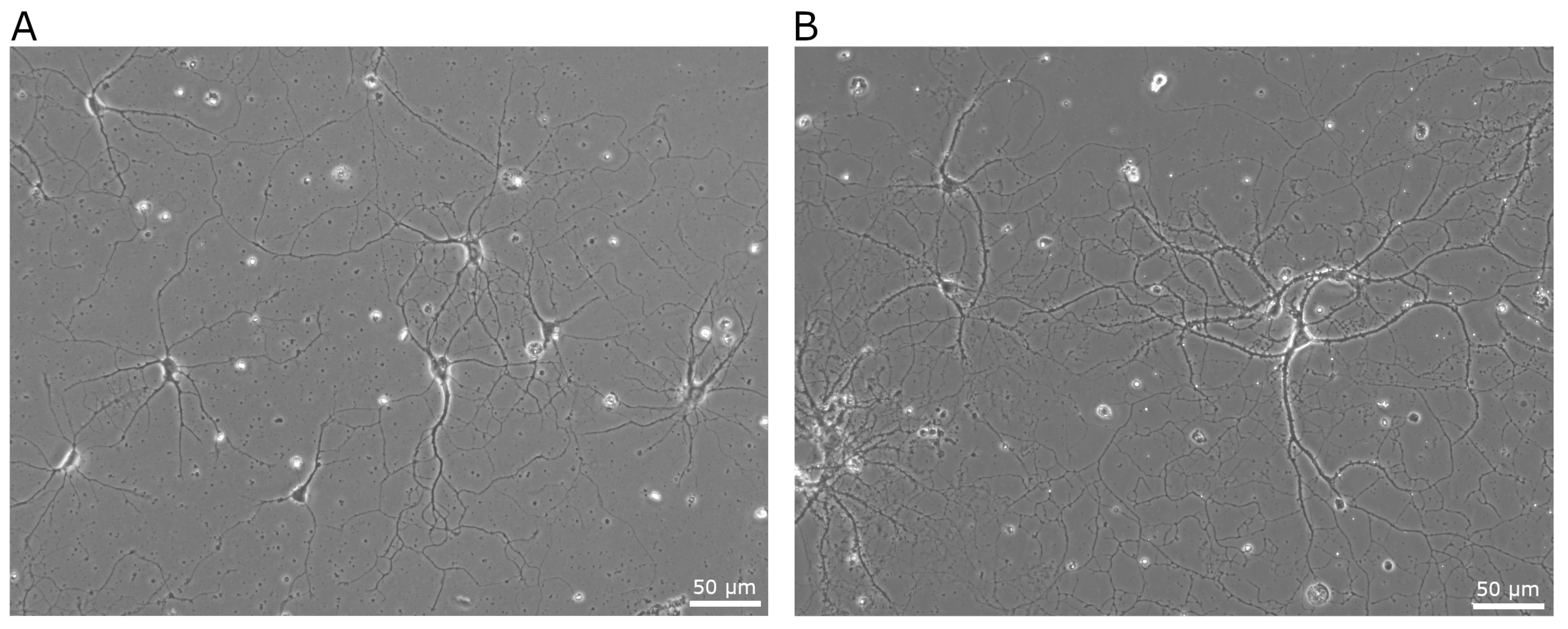 Biosensors 15 00727 g005 Biosensors 15 00727 g005
