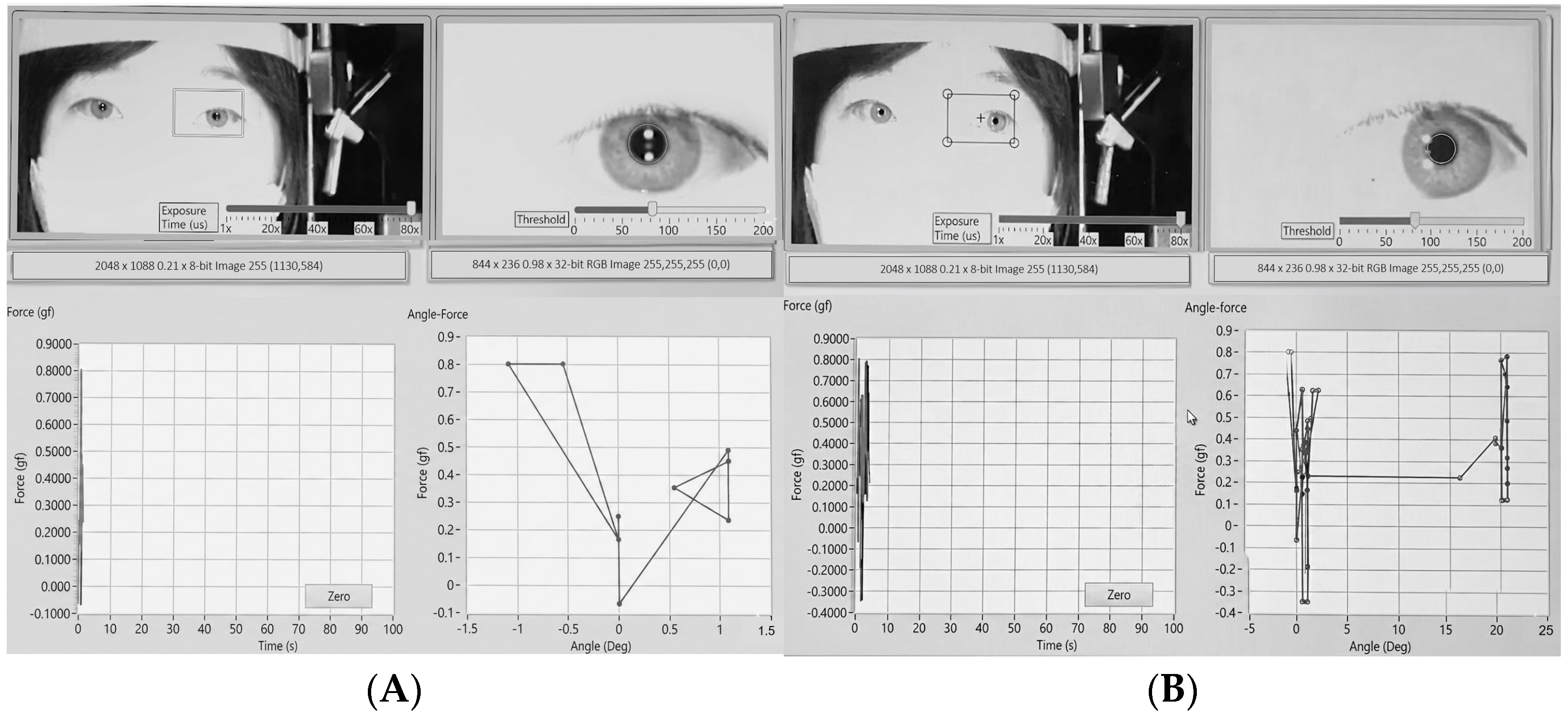 Biosensors 15 00769 g004
