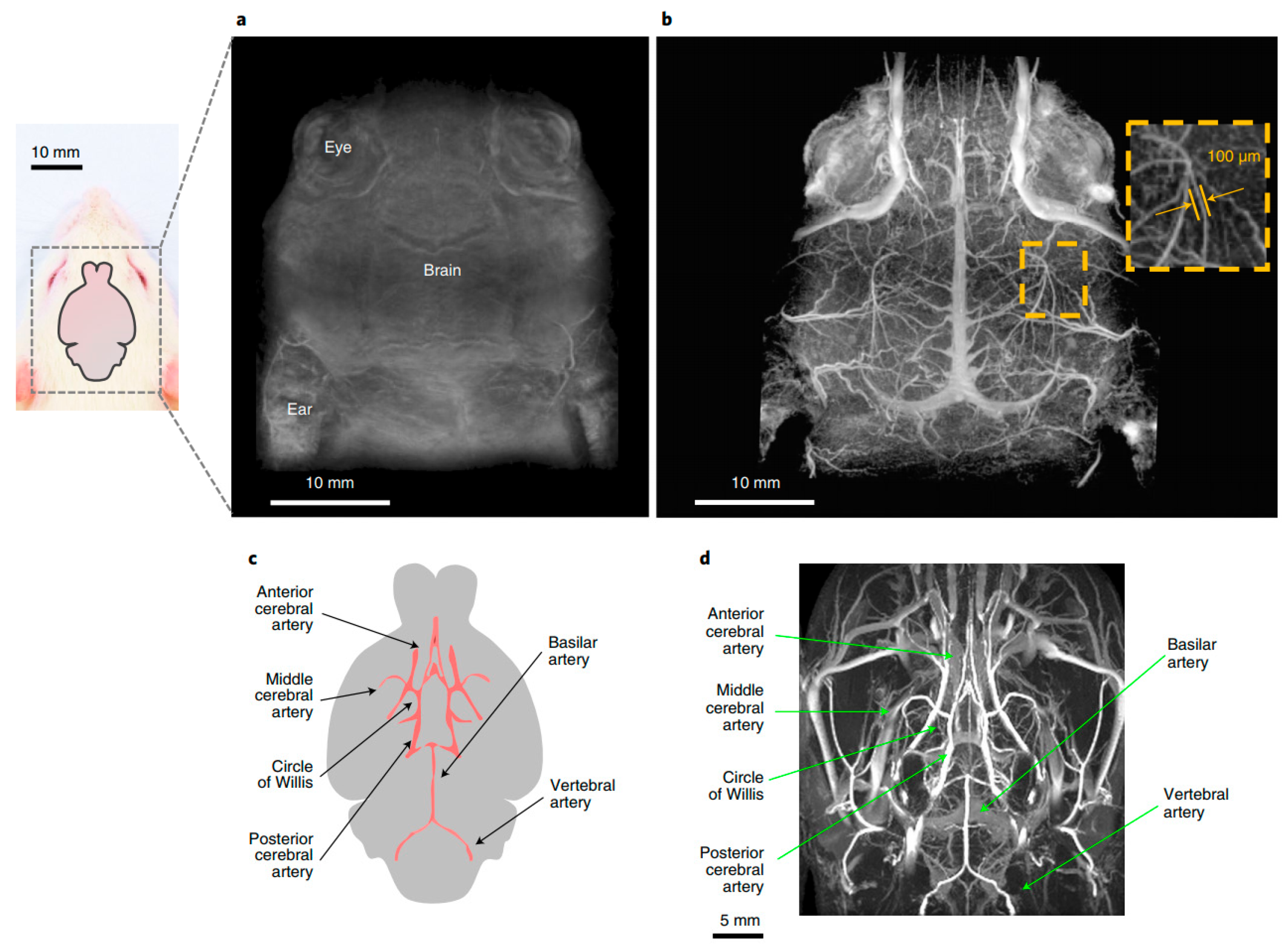 Biosensors 15 00809 g004 Biosensors 15 00809 g004